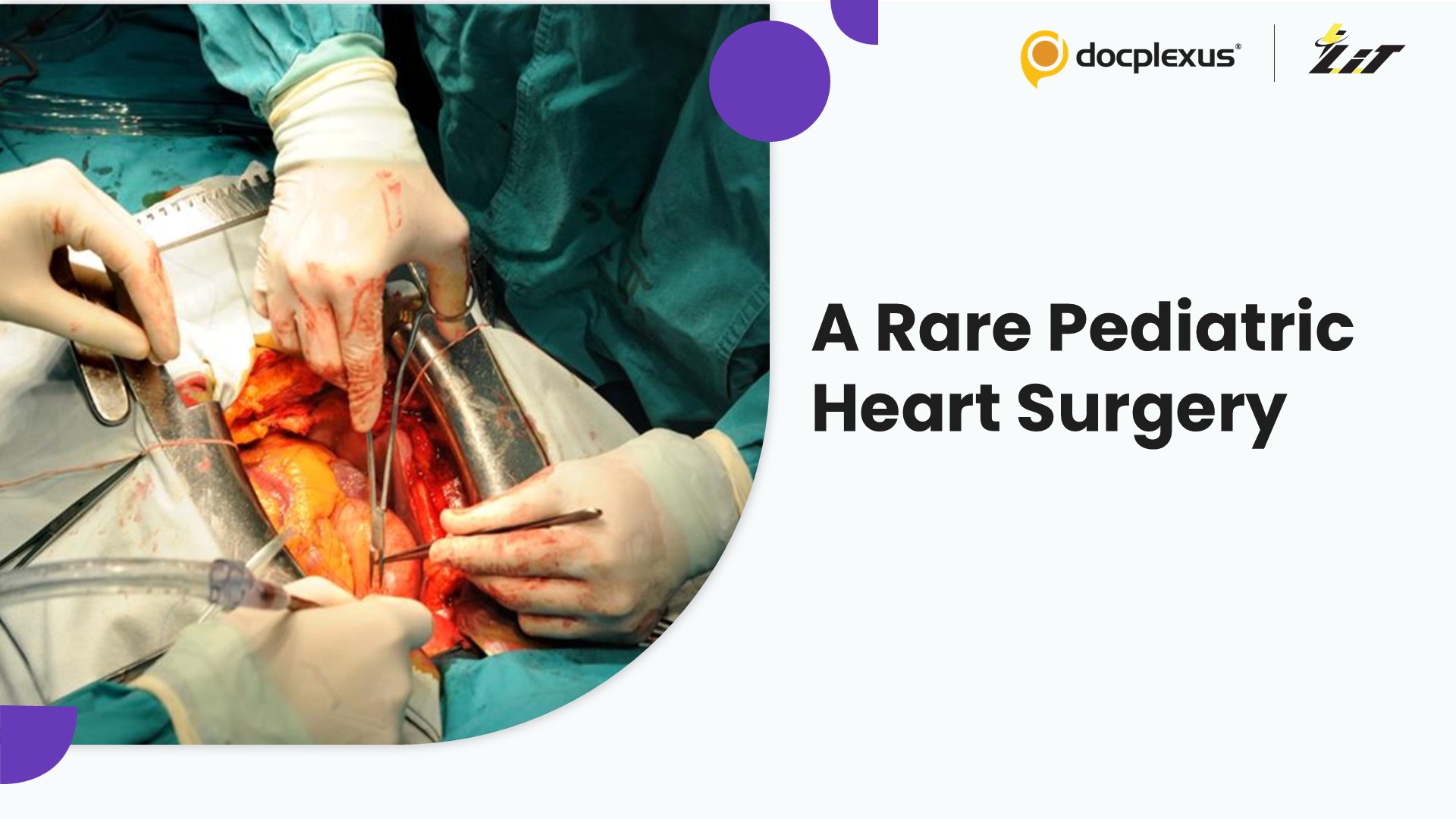 Rare Hybrid Heart Surgery Saves Life of Four-and-a-Half-Year-Old Girl
