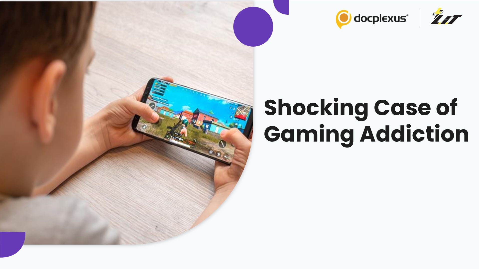 Delhi Doctors Correct Severe Spinal Deformity Linked to Gaming Addiction