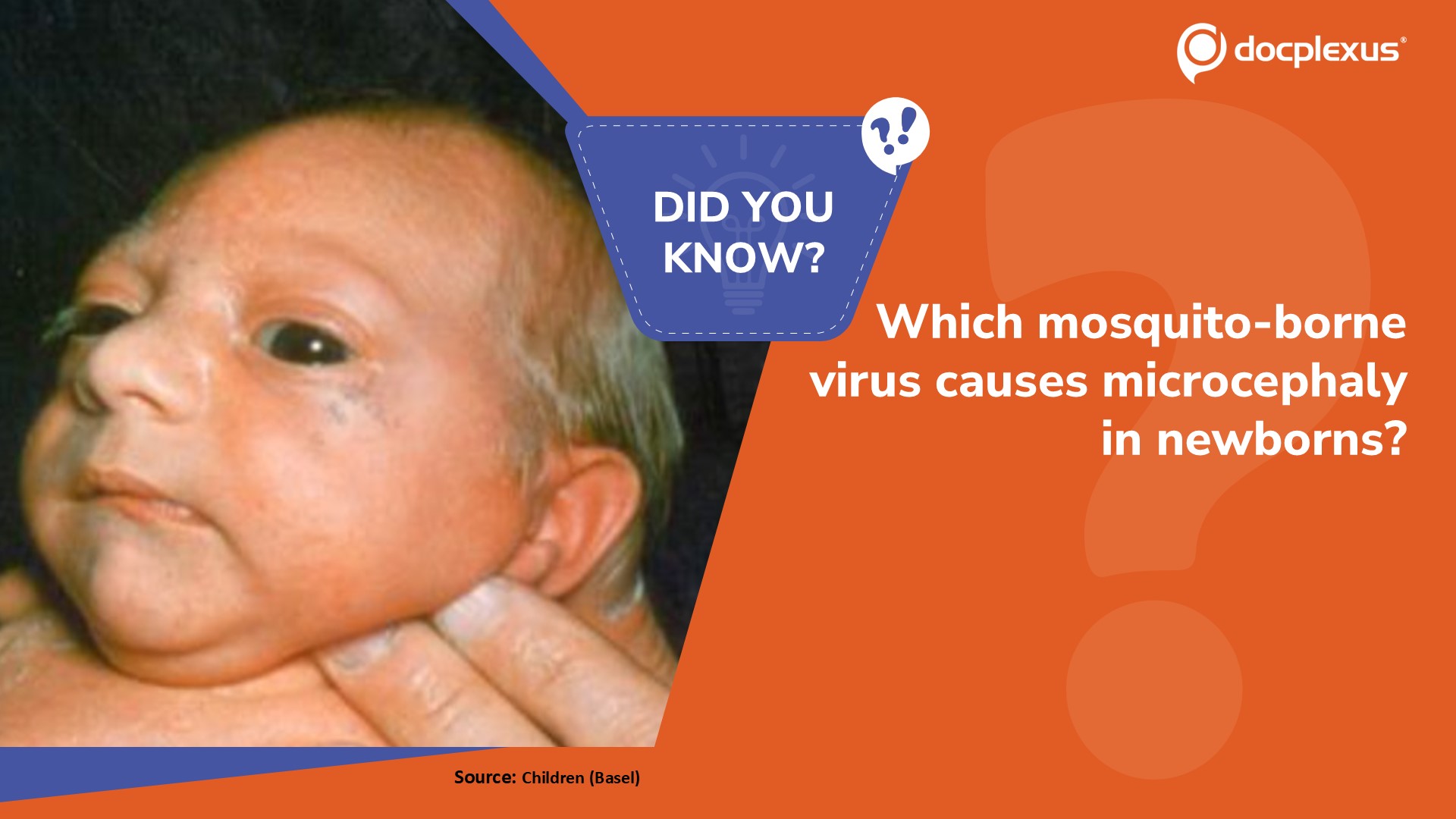 Which Mosquito-borne Virus is Linked to Microcephaly?