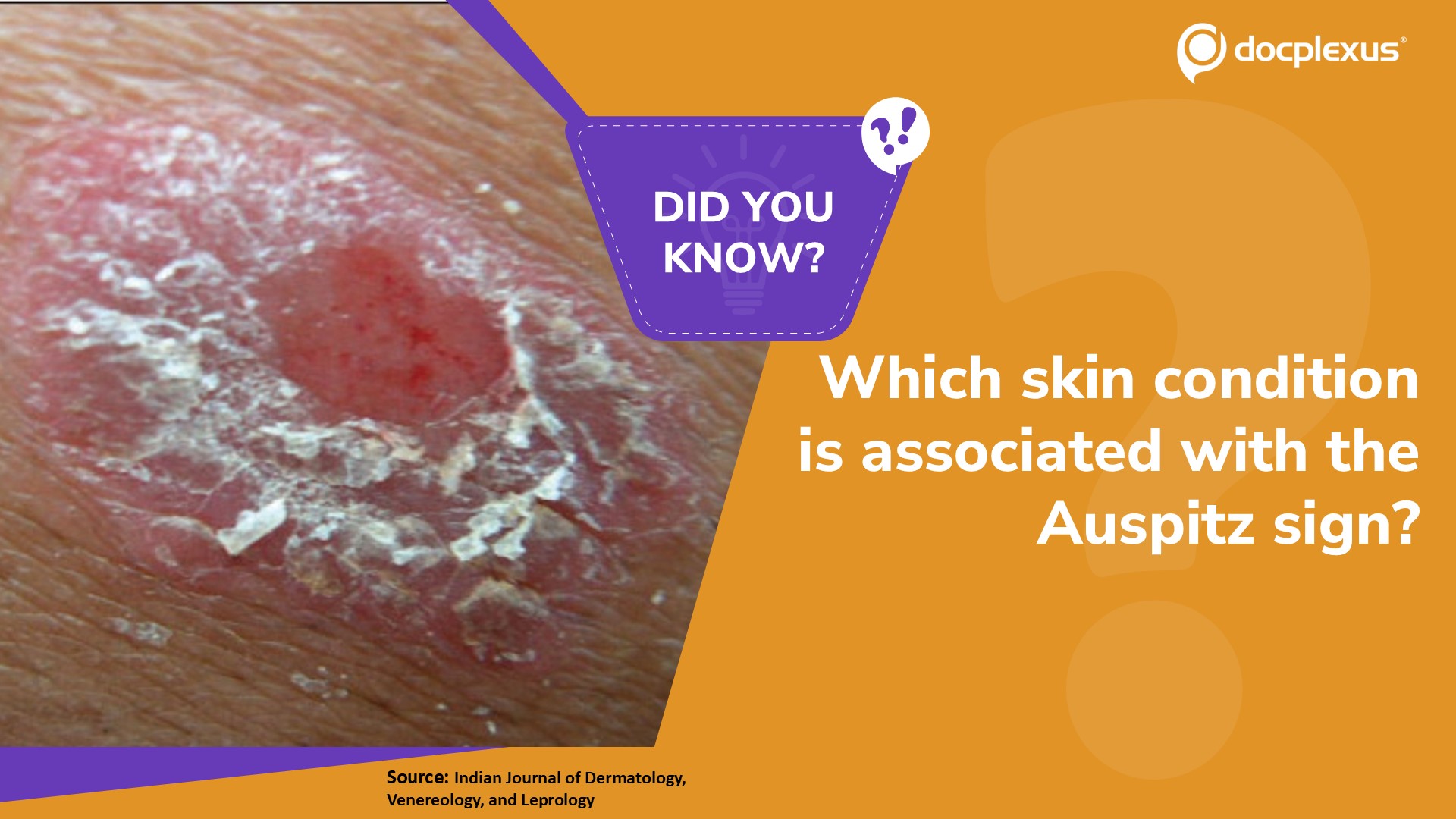 Identify the Skin Condition Associated with the Auspitz Sign