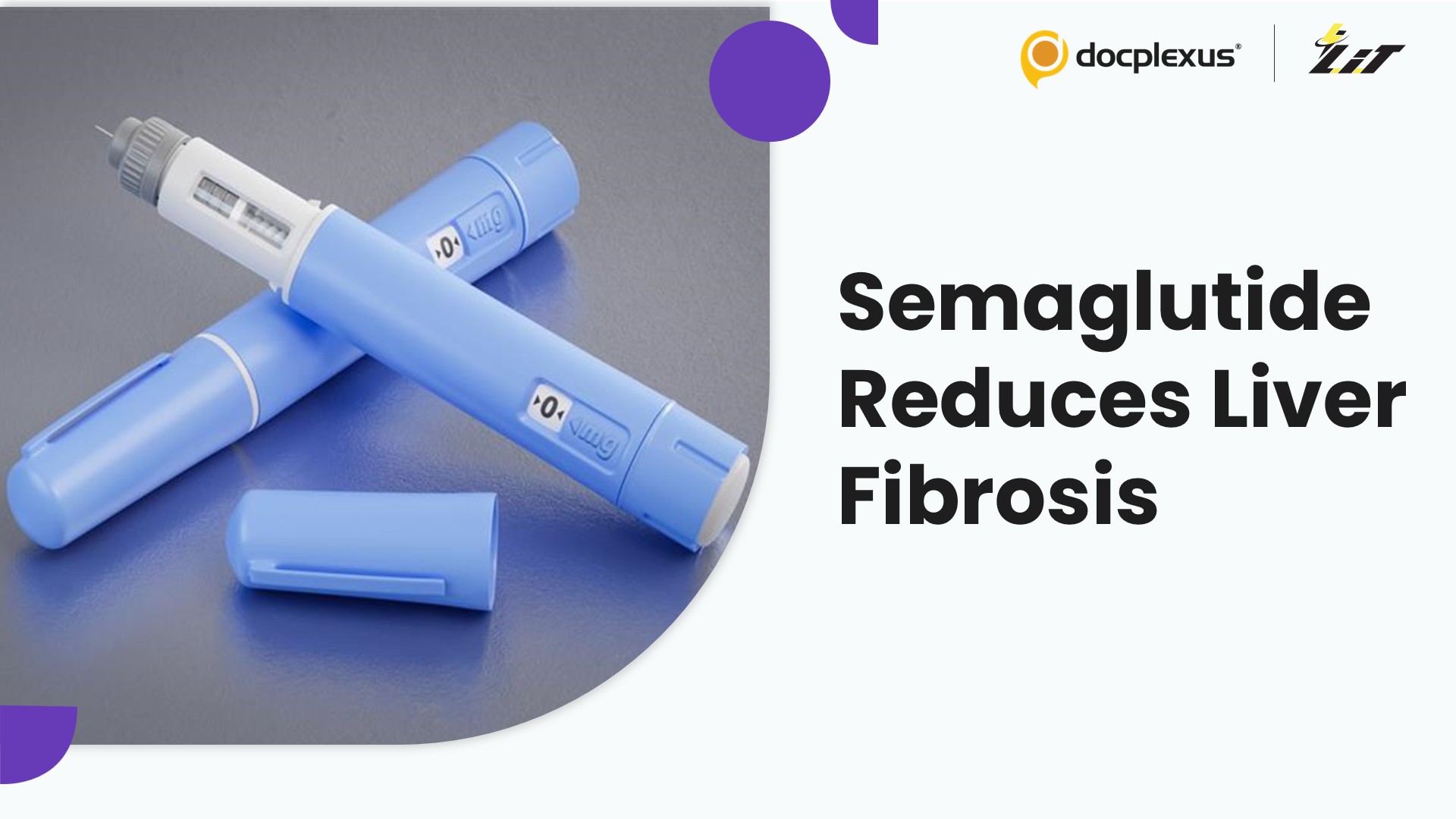 Semaglutide Reduces Steatohepatitis and Fibrosis in Mash Patients