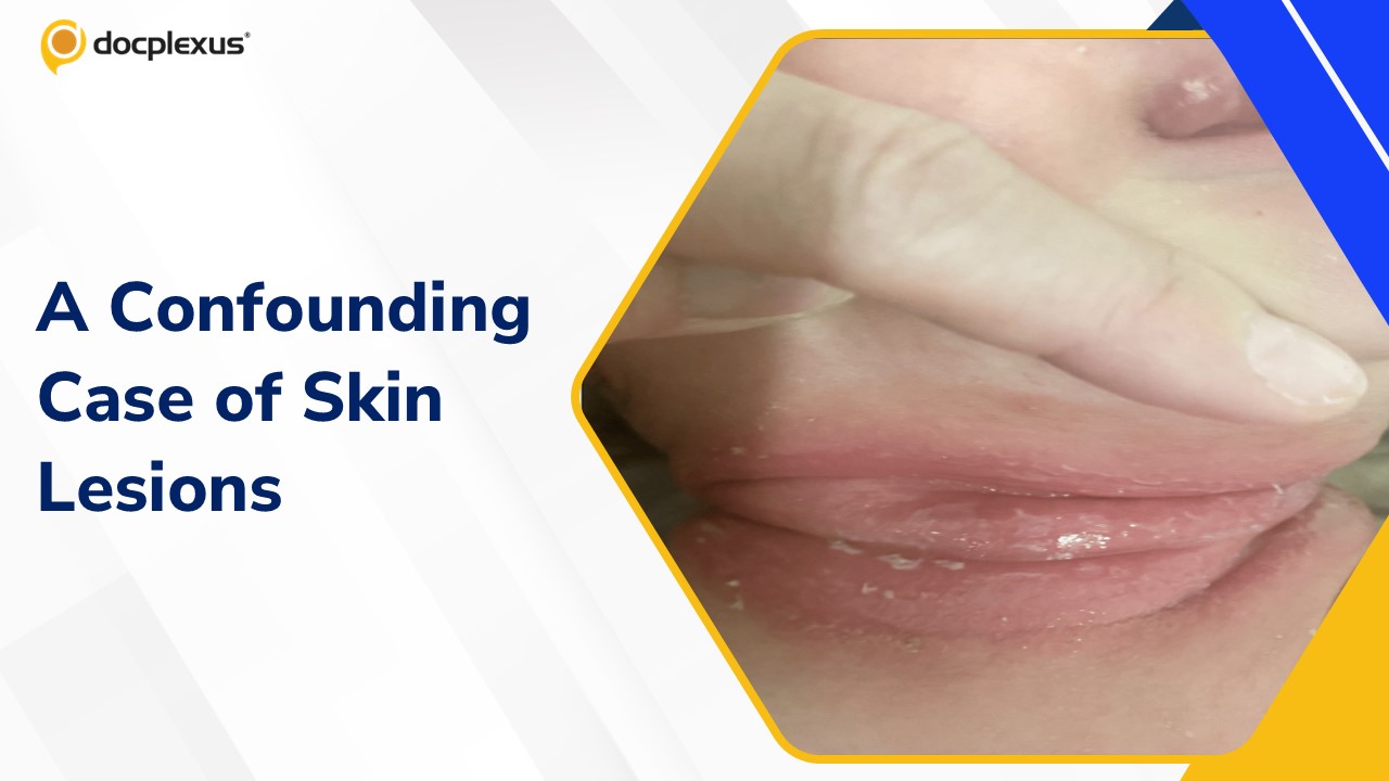 Diagnose This Challenging Case of Infant Skin Lesions