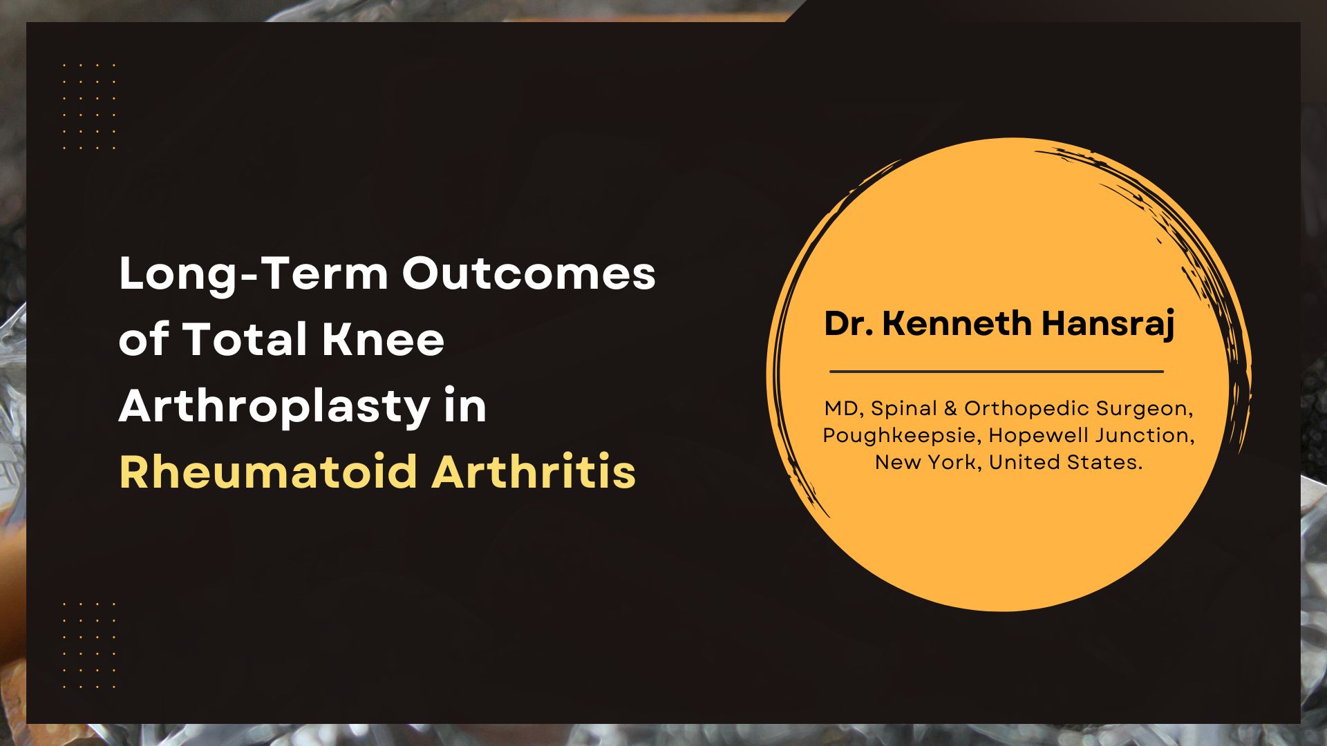 Long-term Results of Total Condylar Knee Arthroplasty in Rheumatoid Arthritis
