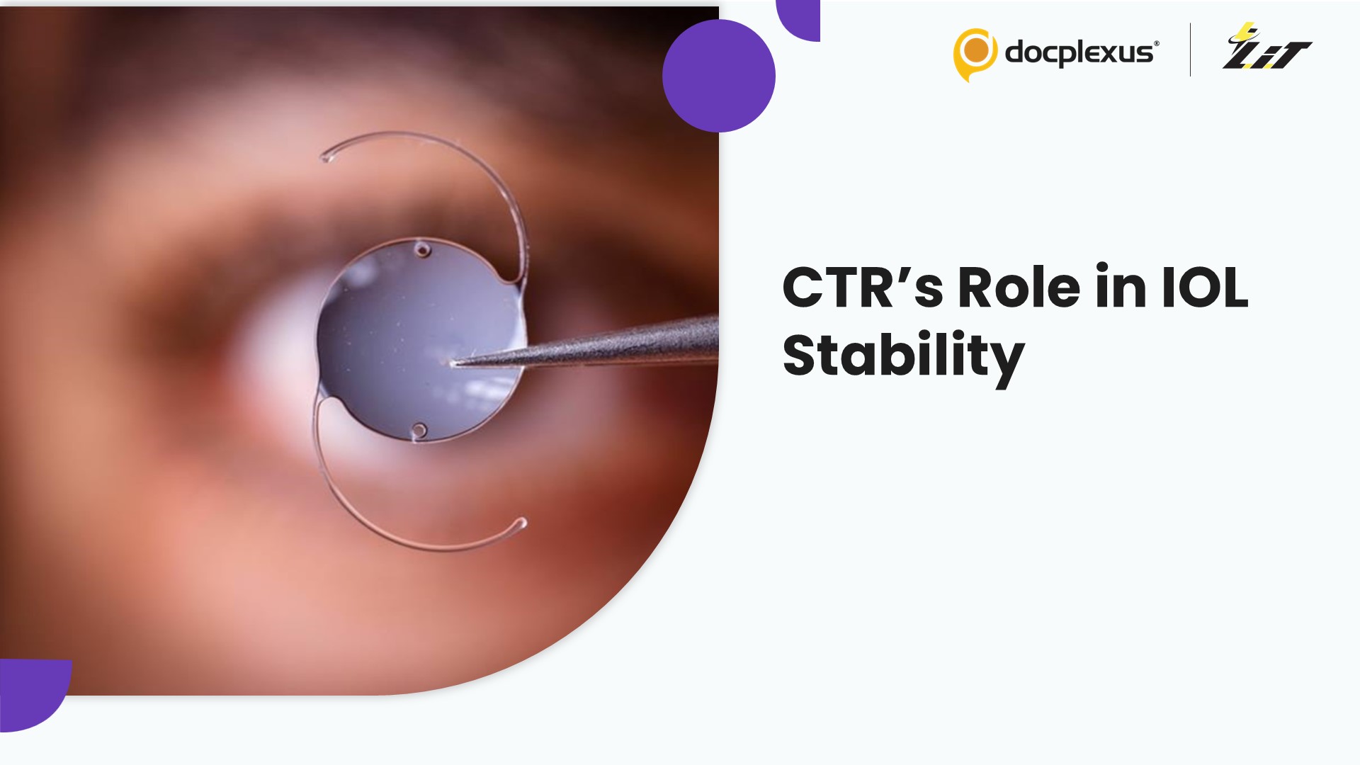 Capsular Tension Rings are Associated with Enhanced IOL Positioning