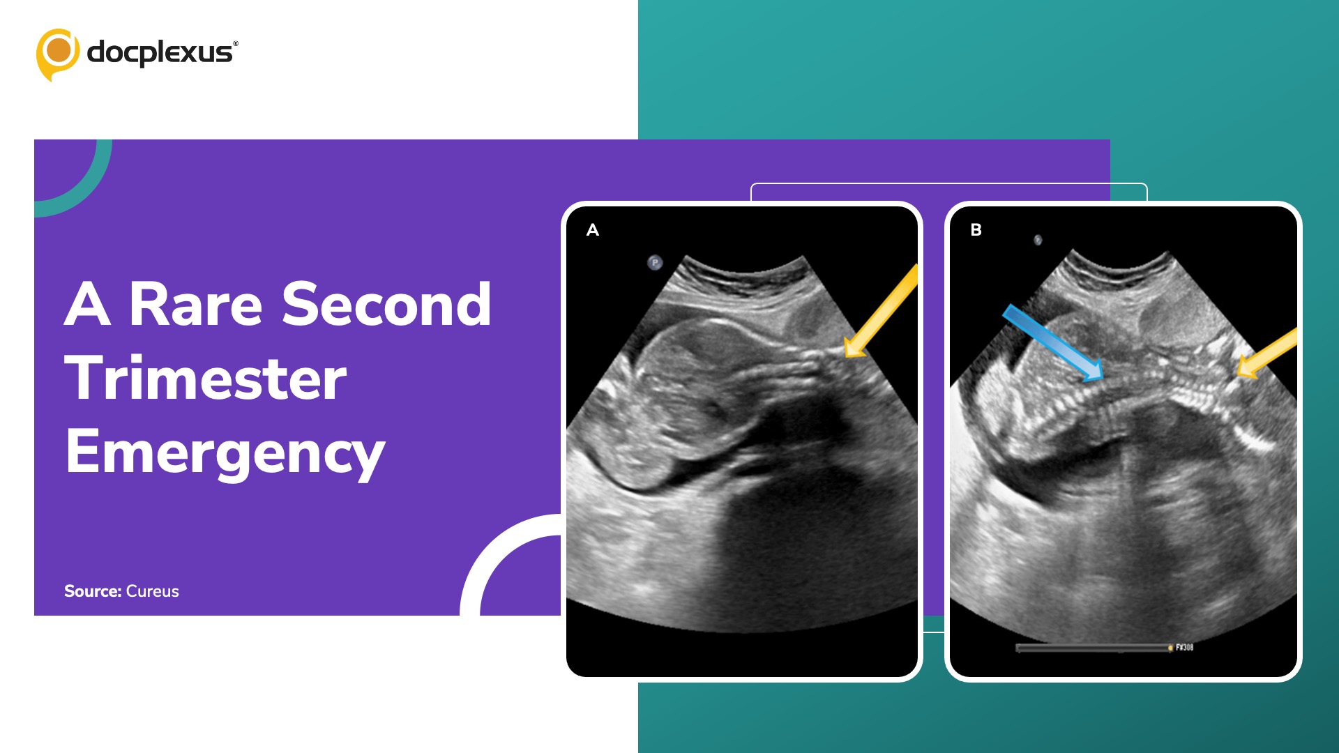 Diagnose This Unexpected Second Trimester Complication
