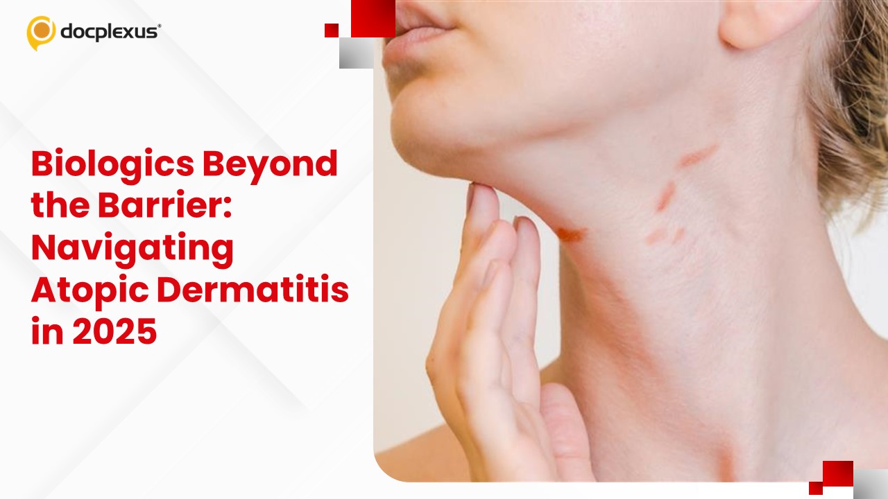Biologics Beyond the Barrier: Navigating Atopic Dermatitis in 2025