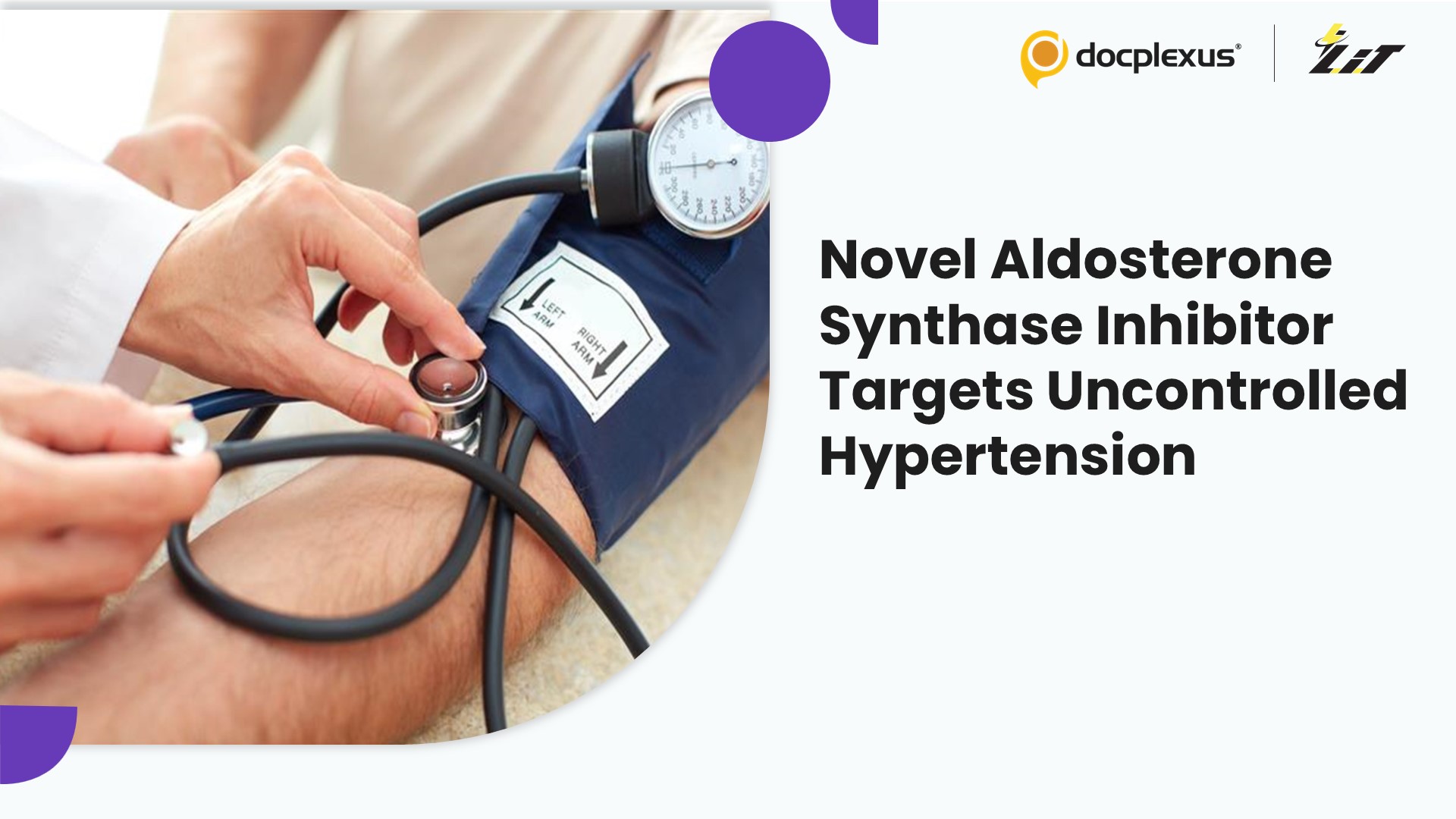Novel Aldosterone Synthase Inhibitor Targets Uncontrolled Hypertension