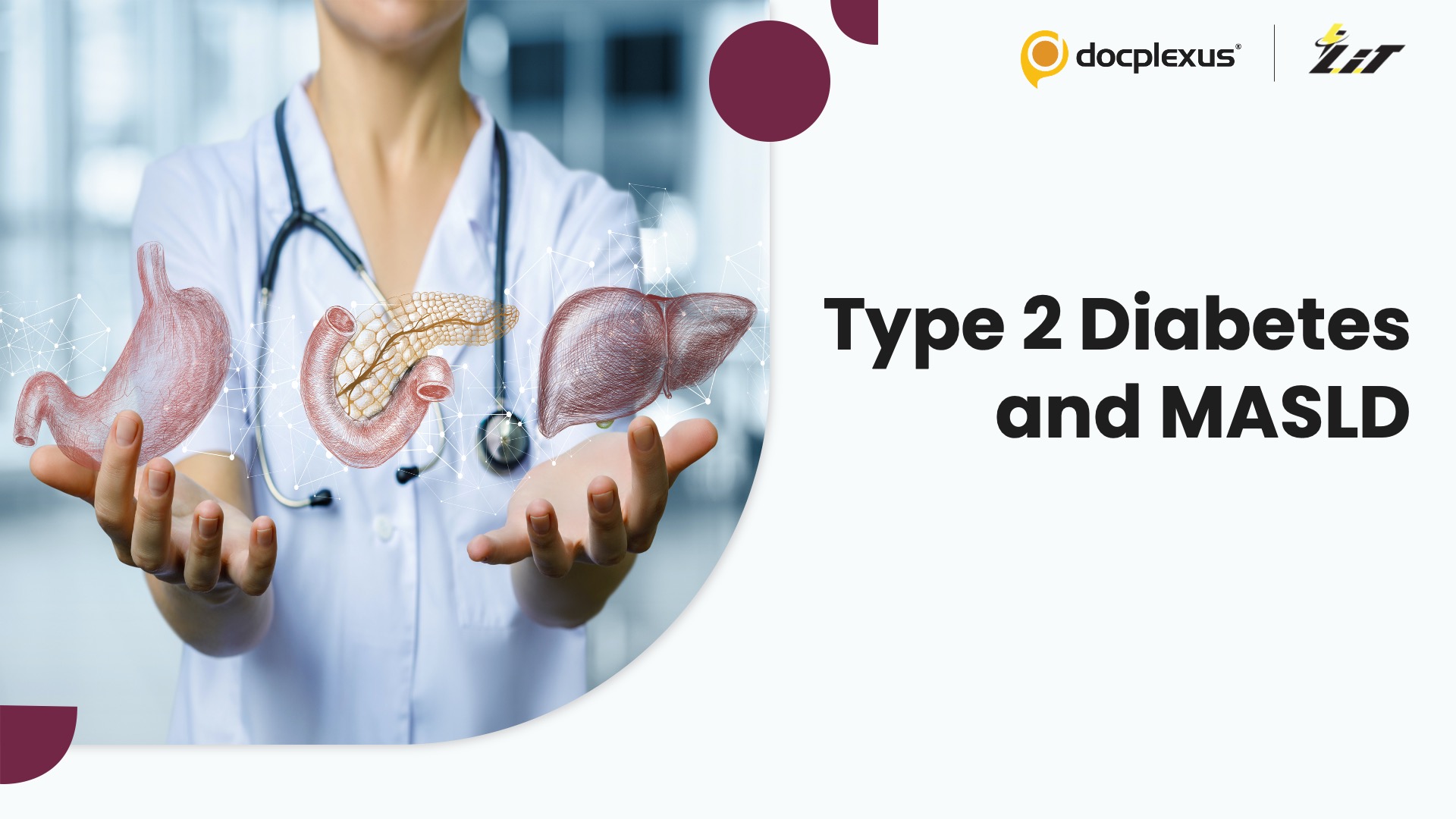 How Strongly is Type 2 Diabetes Associated with MASLD and Cirrhosis?