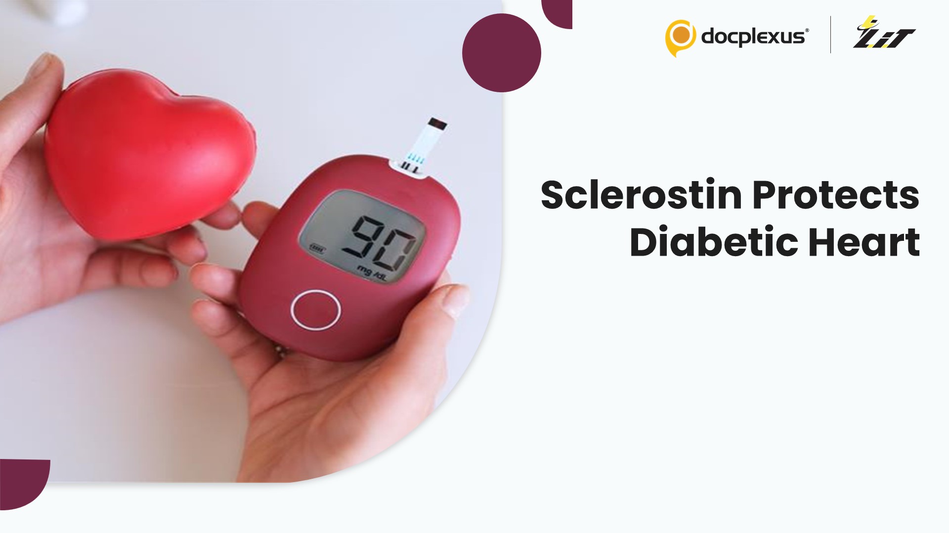 Sclerostin Linked to Cardiovascular Protection in Type 2 Diabetes