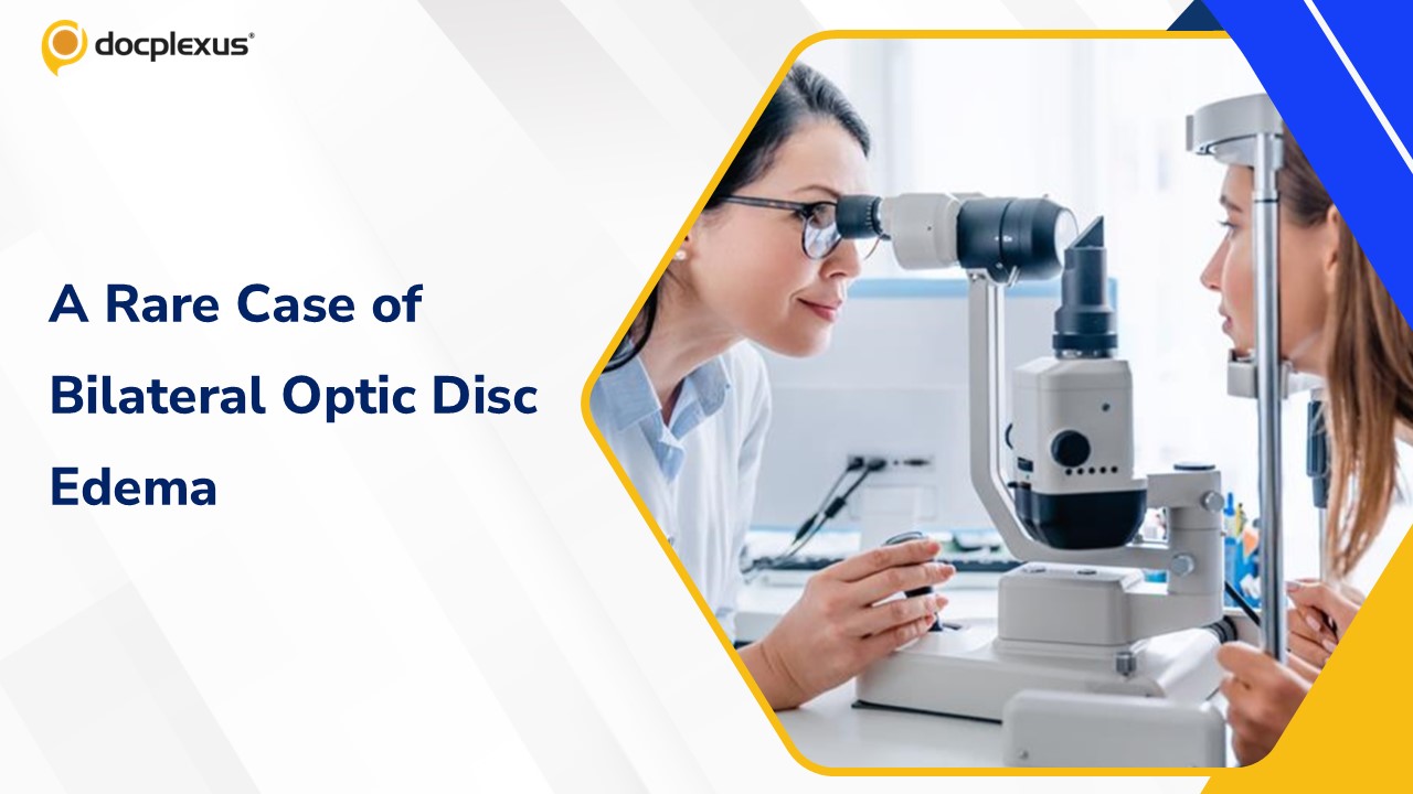 Diagnose This Rare Case of Bilateral Optic Disc Edema