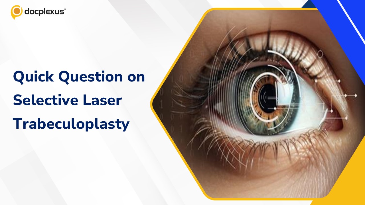 An Overview of Selective Laser Trabeculoplasty in Glaucoma Management