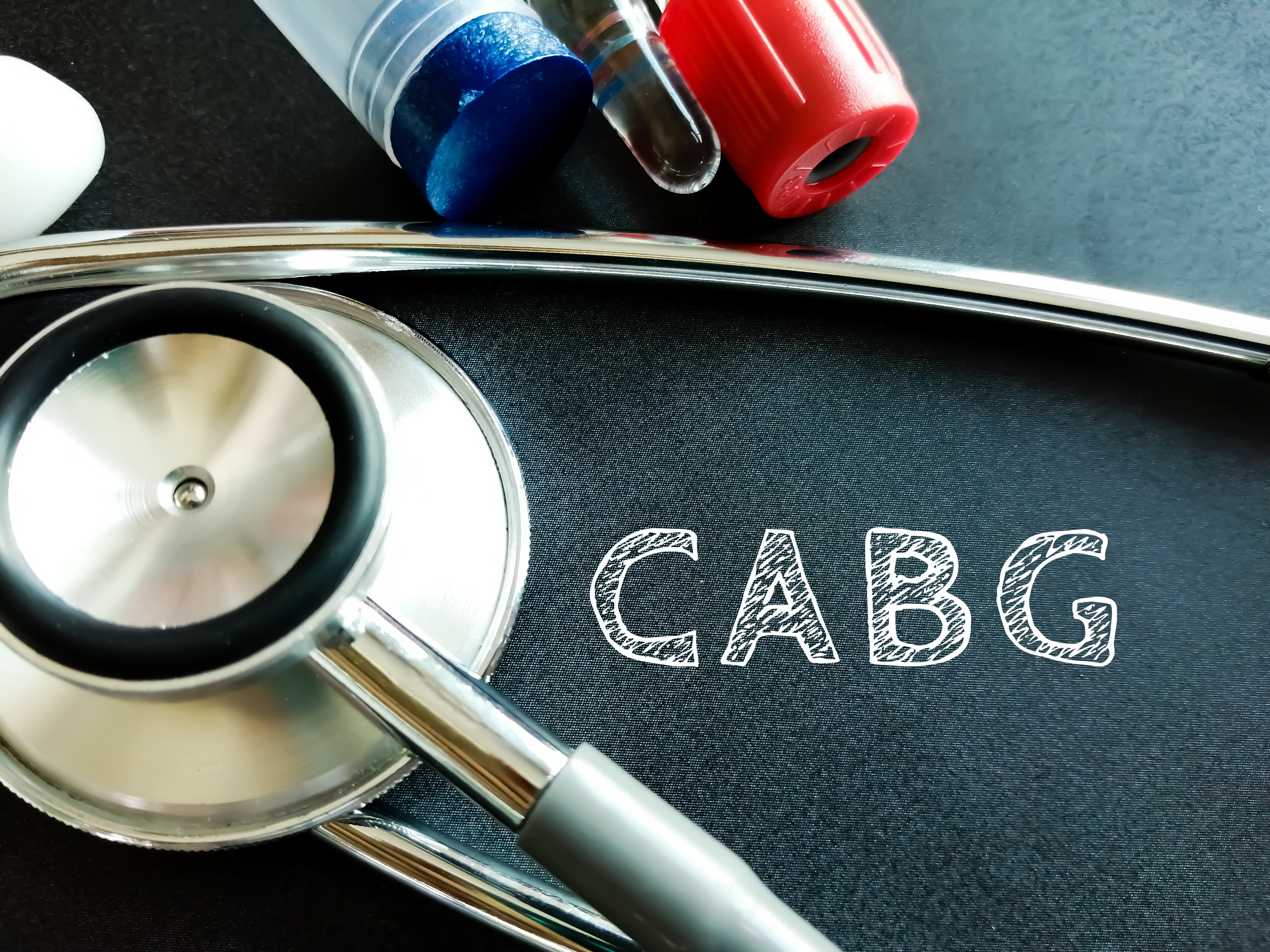 Coronary bypass grafting is an Extra vascular  repair/ correction  WHILE Coronary stenting  is an Endo vascular Repair=So Coronary Bypass is Superior