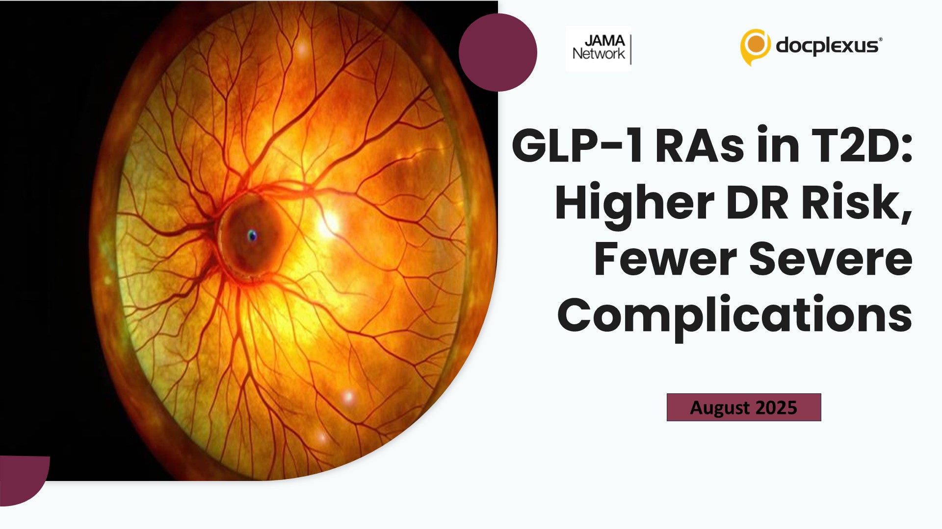 GLP-1 RAs in T2D: Higher DR Risk, Fewer Severe Complications