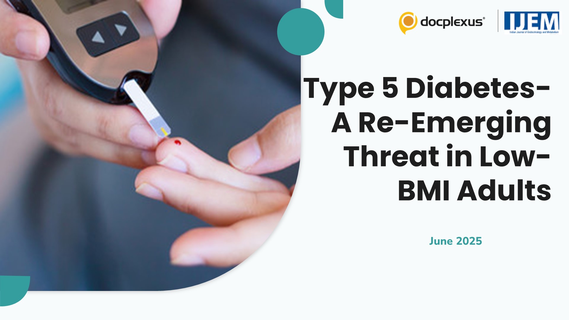 Type 5 Diabetes—A Re-Emerging Threat in Low-BMI Adults
