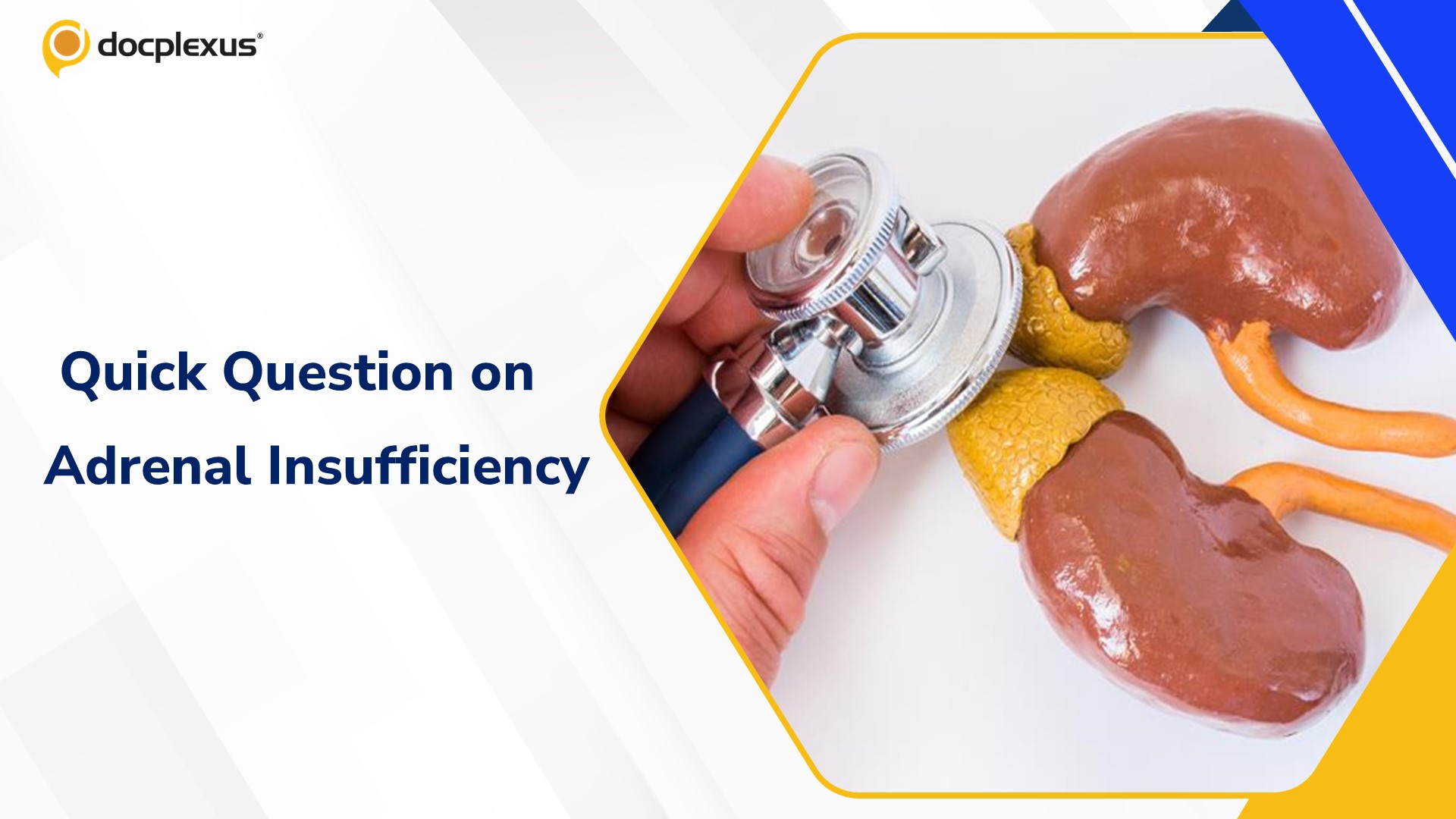 Think You Know Adrenal Insufficiency Diagnosis? Quick Quiz