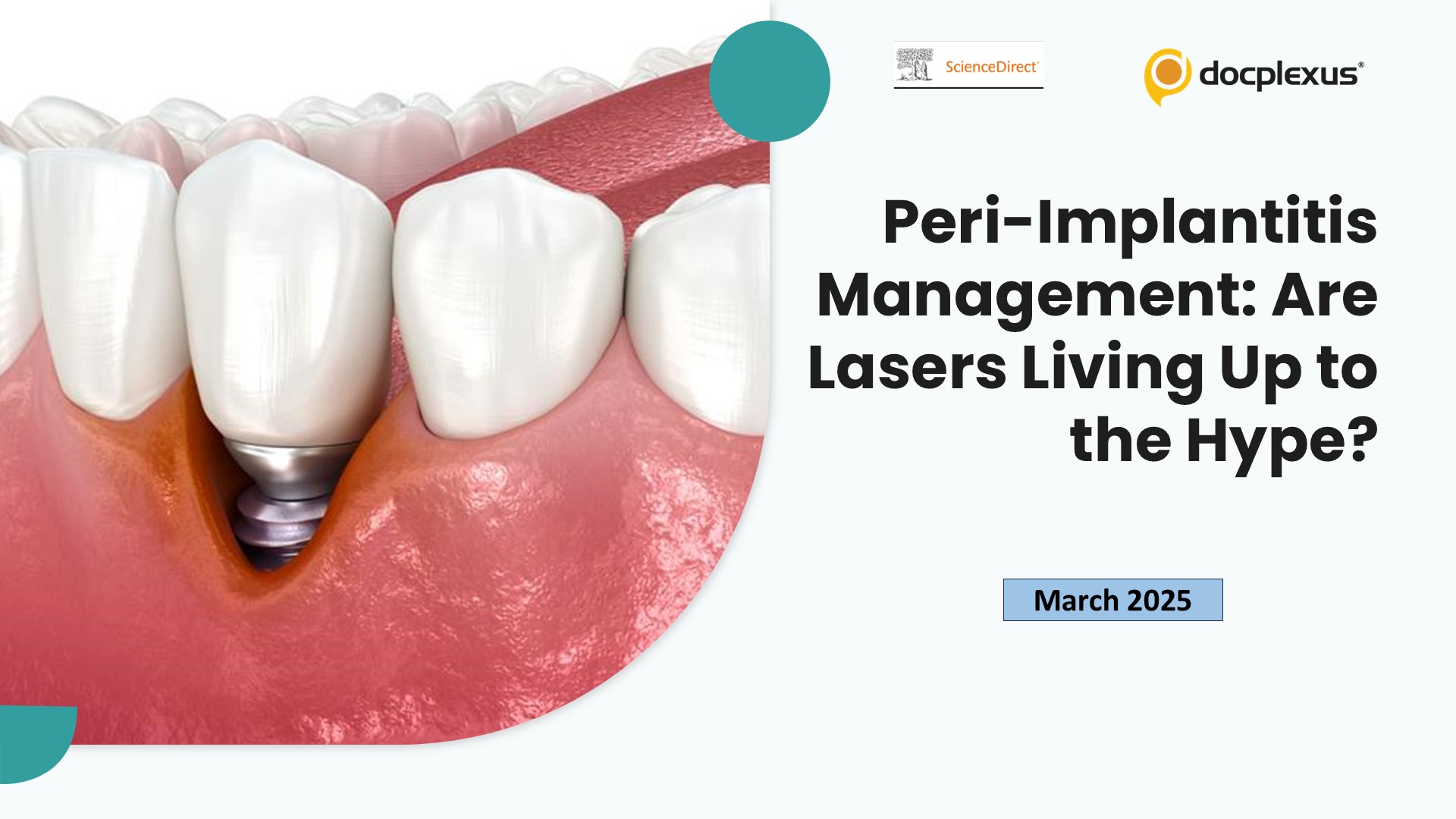 Peri-Implantitis Management: Are Lasers Living Up to the Hype?