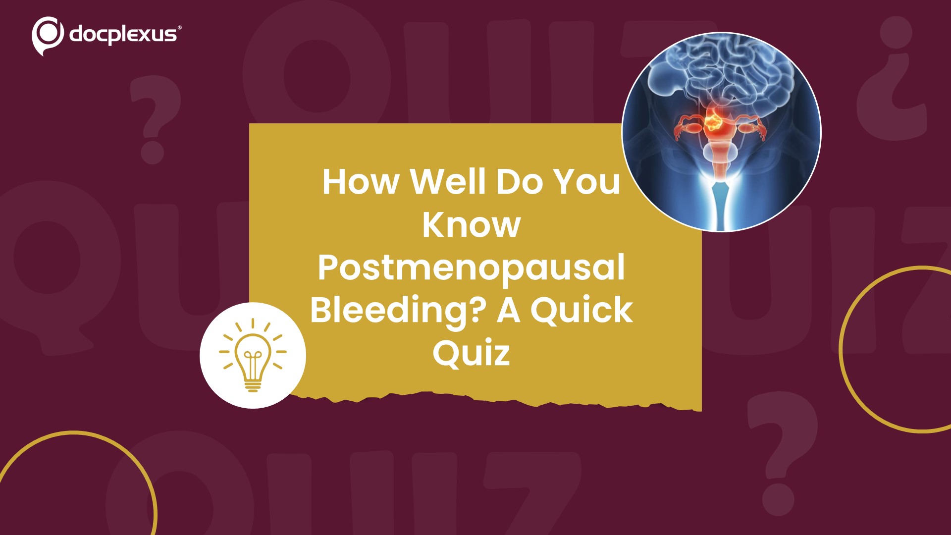 Understanding Postmenopausal Bleeding: A Quick Quiz
