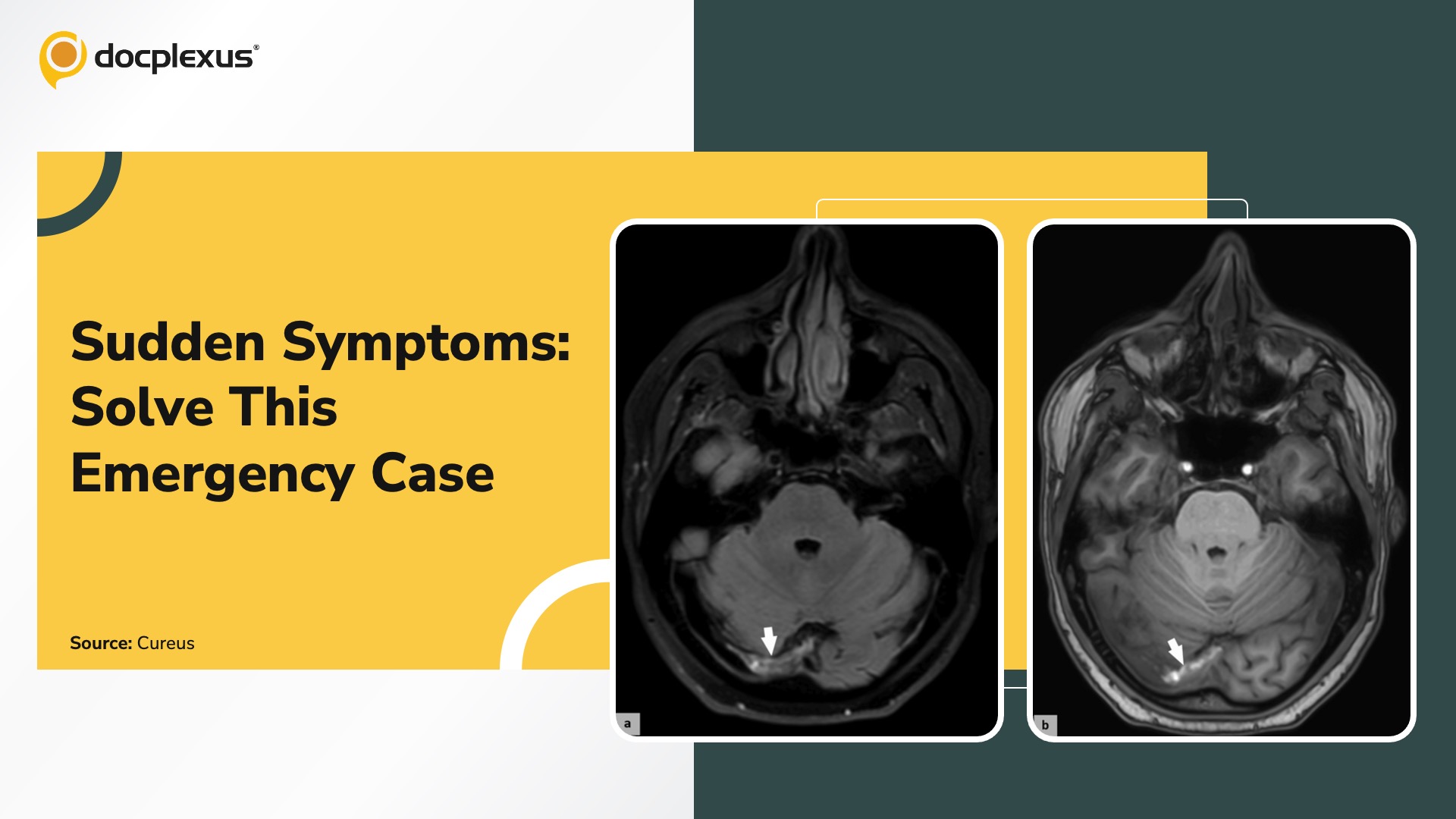 Sudden-onset Vomiting and Lethargy: Can You Solve This Case?