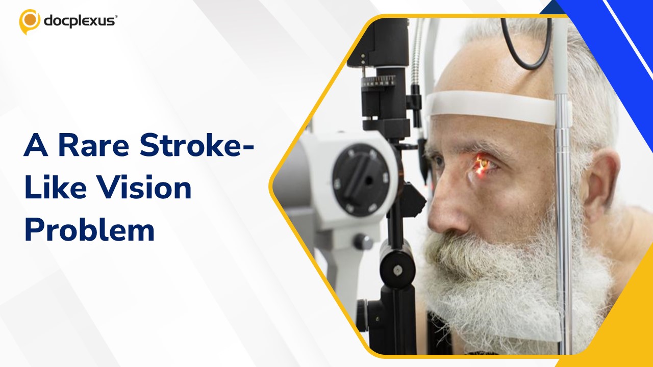 Diagnose This Rare Ophthalmic Stroke Mimic