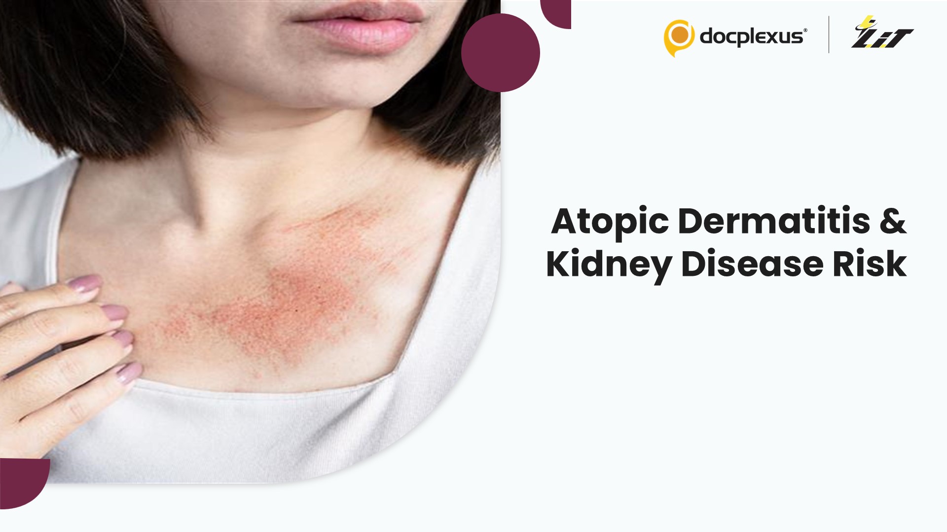 Skin Condition Tied to Silent Kidney Damage?