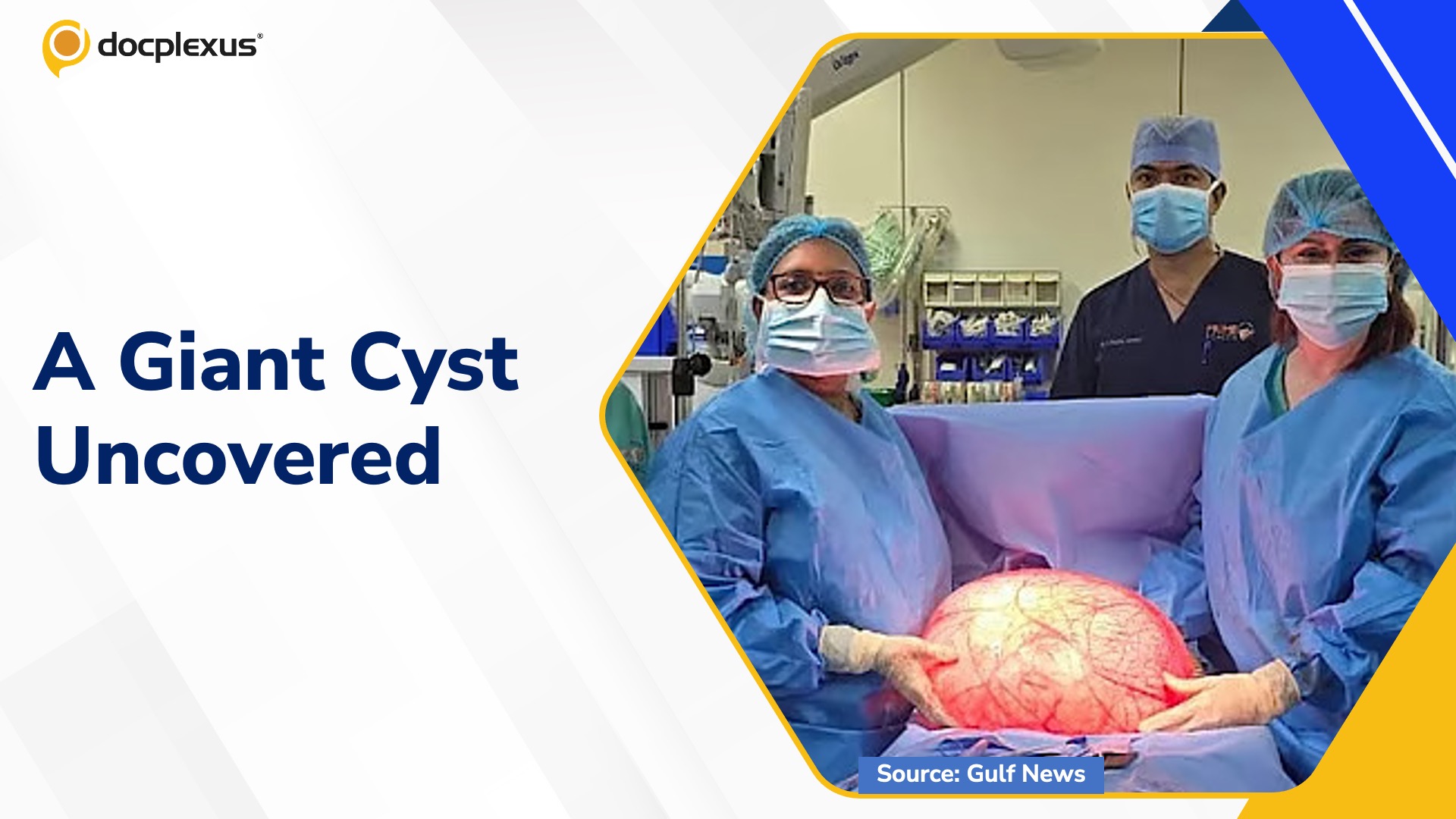A Rare Case of a 14.5 kg Ovarian Cyst and Lessons for Everyday Practice