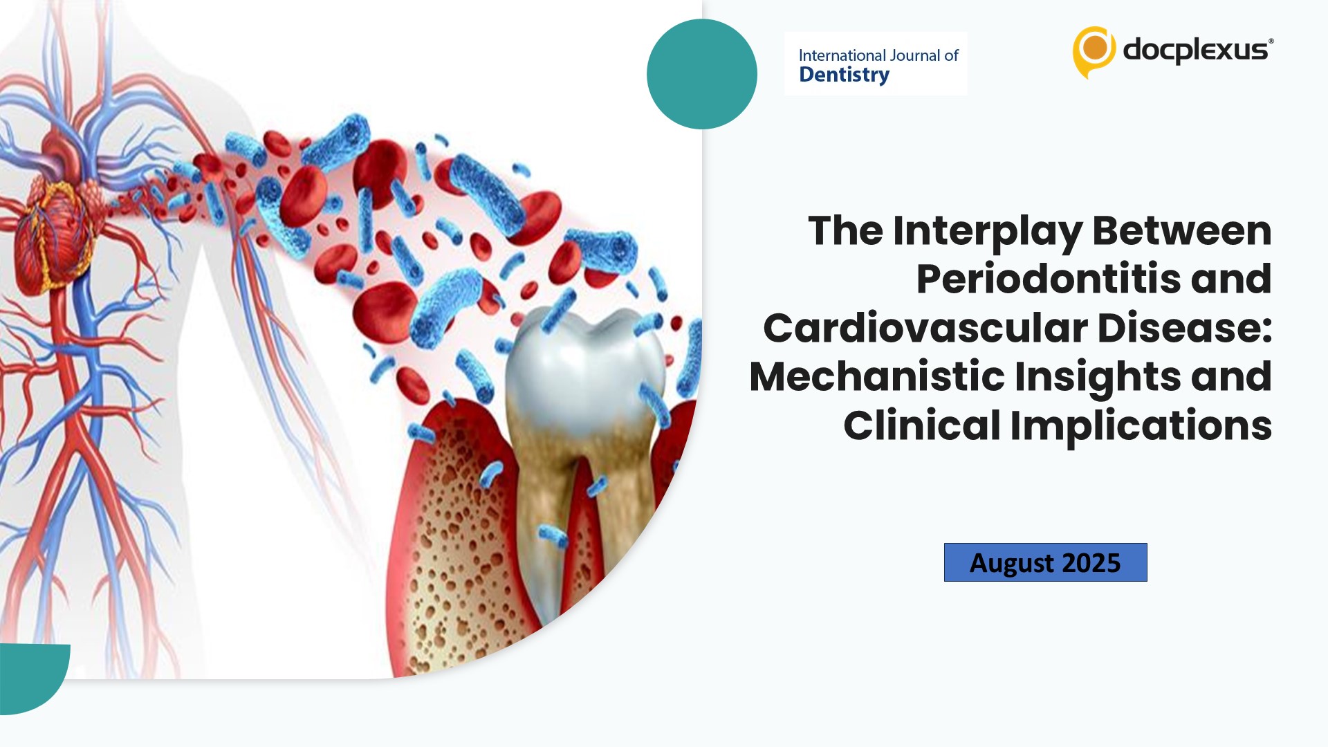 The Interplay Between Periodontitis and Cardiovascular Disease: Mechanistic Insights and Clinical Implications