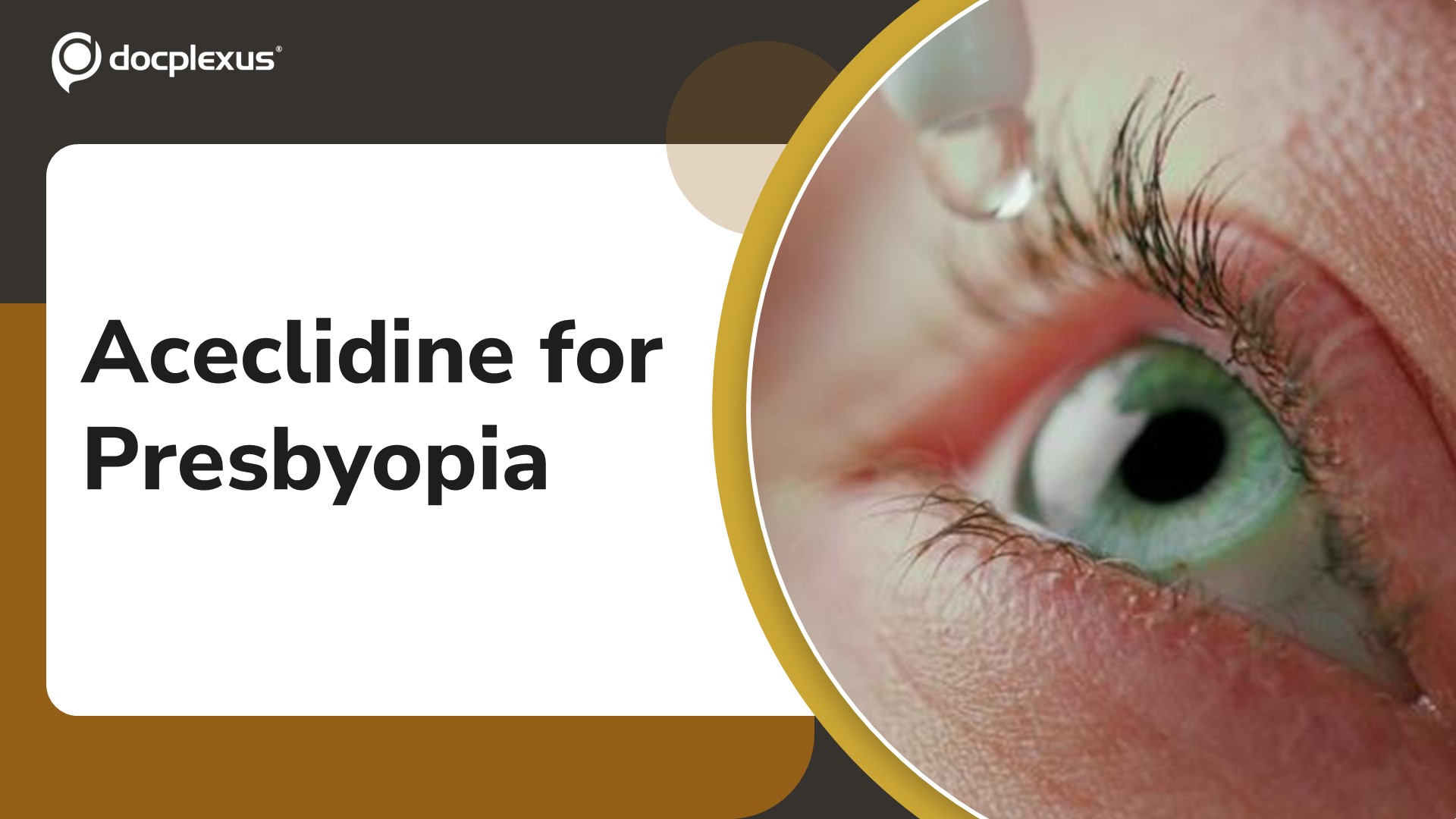 USFDA Approves Aceclidine Ophthalmic Solution for Presbyopia