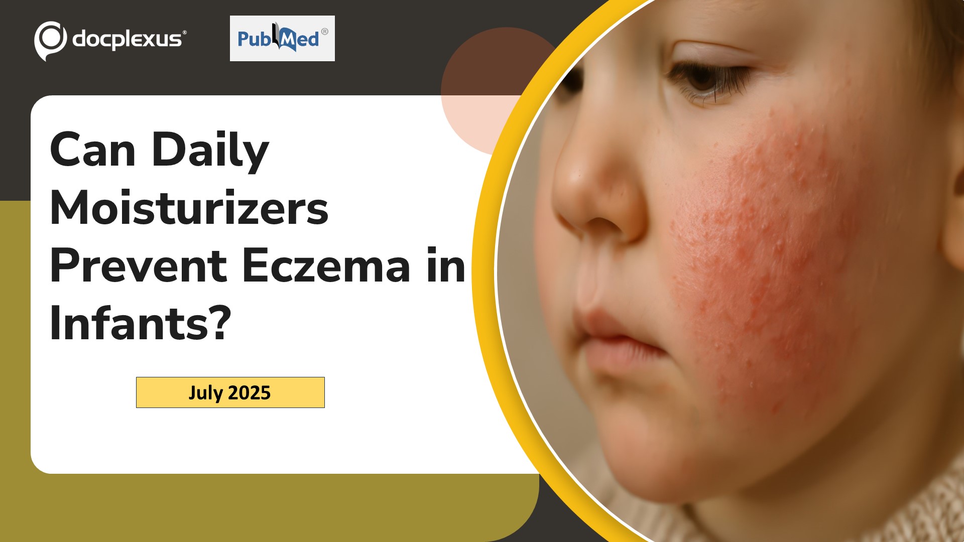 Can Daily Moisturizers Prevent Eczema in Infants?