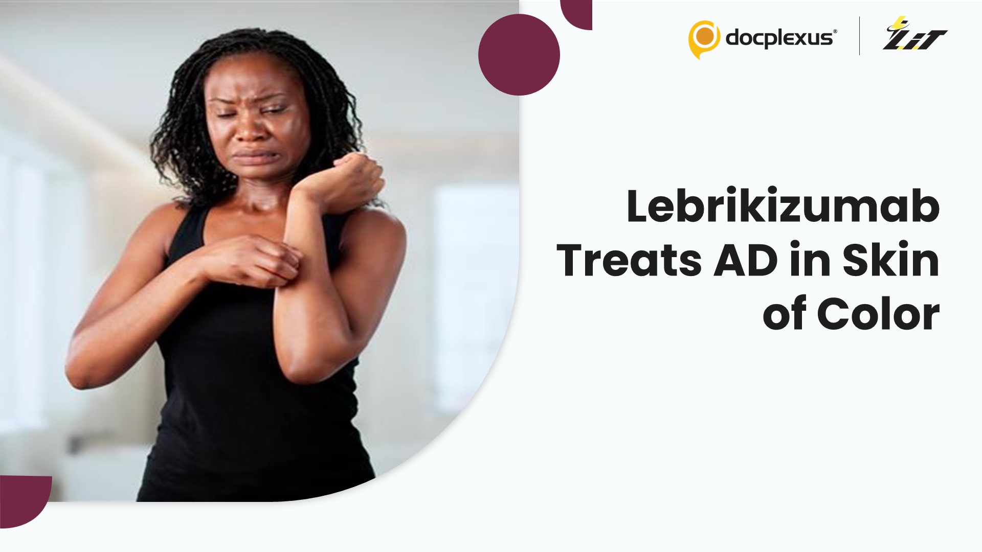 Lebrikizumab Shows Promising Results in Atopic Dermatitis Across Skin Phototypes