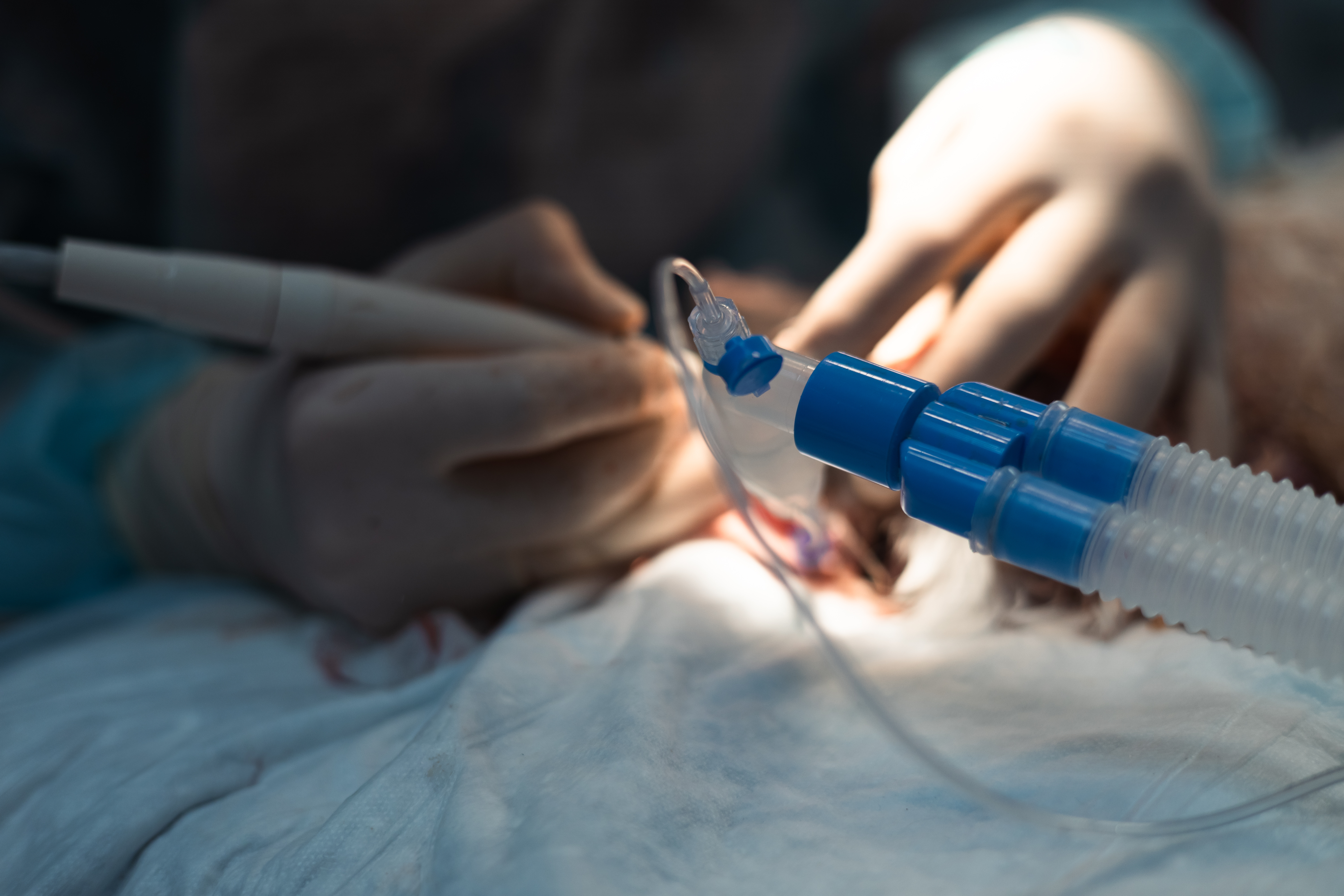 Bougie Intubation Made Easy: Practical Tips That Work