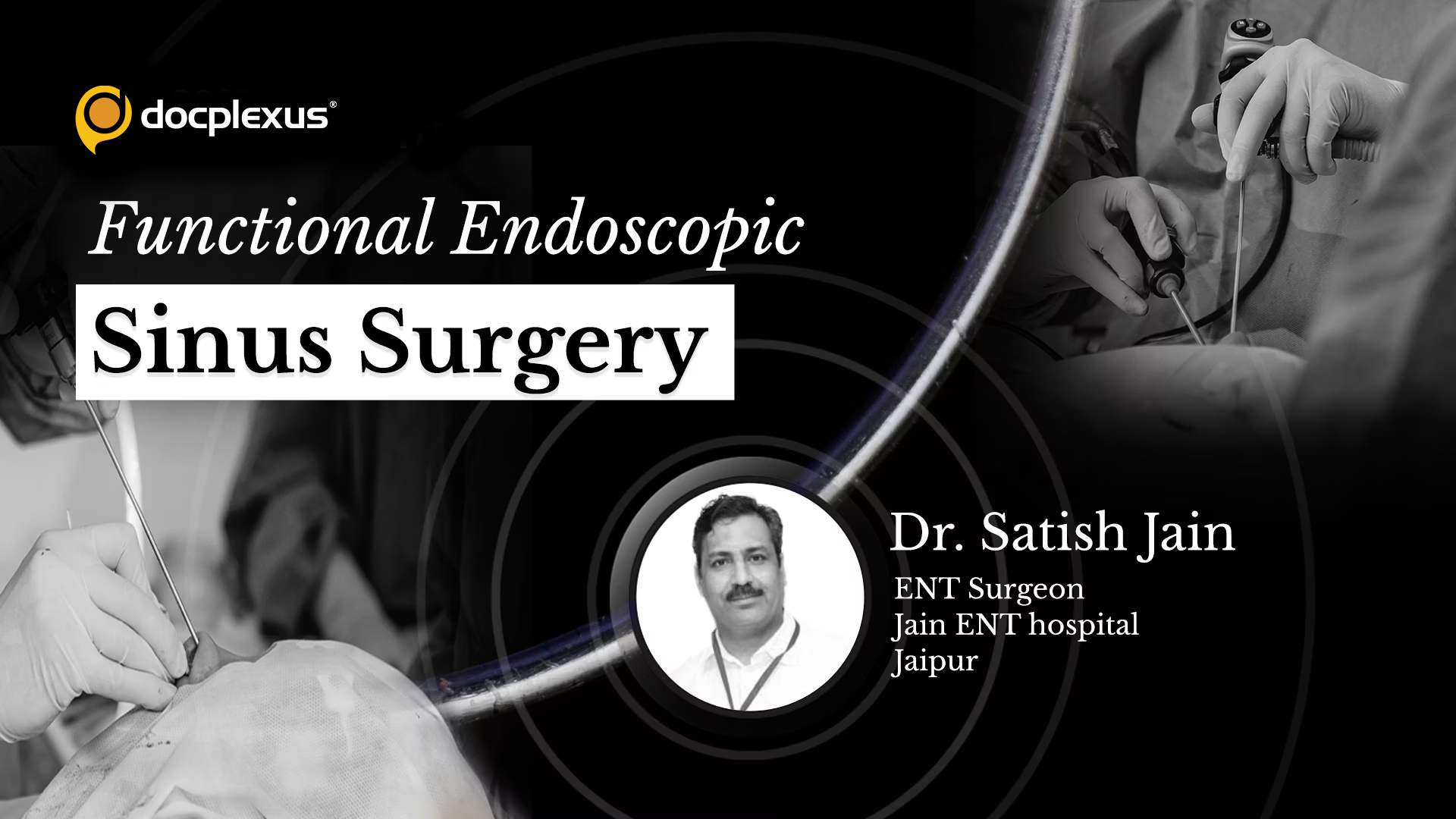 Functional Endoscopic Sinus Surgery