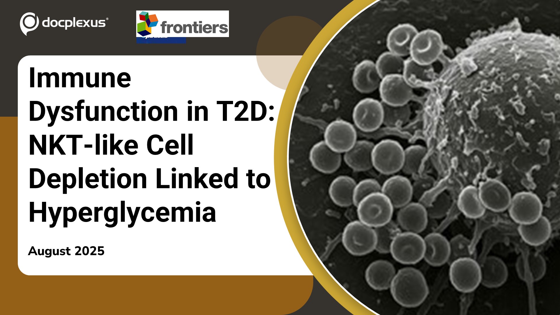 Immune Dysfunction in Type 2 Diabetes: NKT-like Cell Depletion Linked to Hyperglycemia