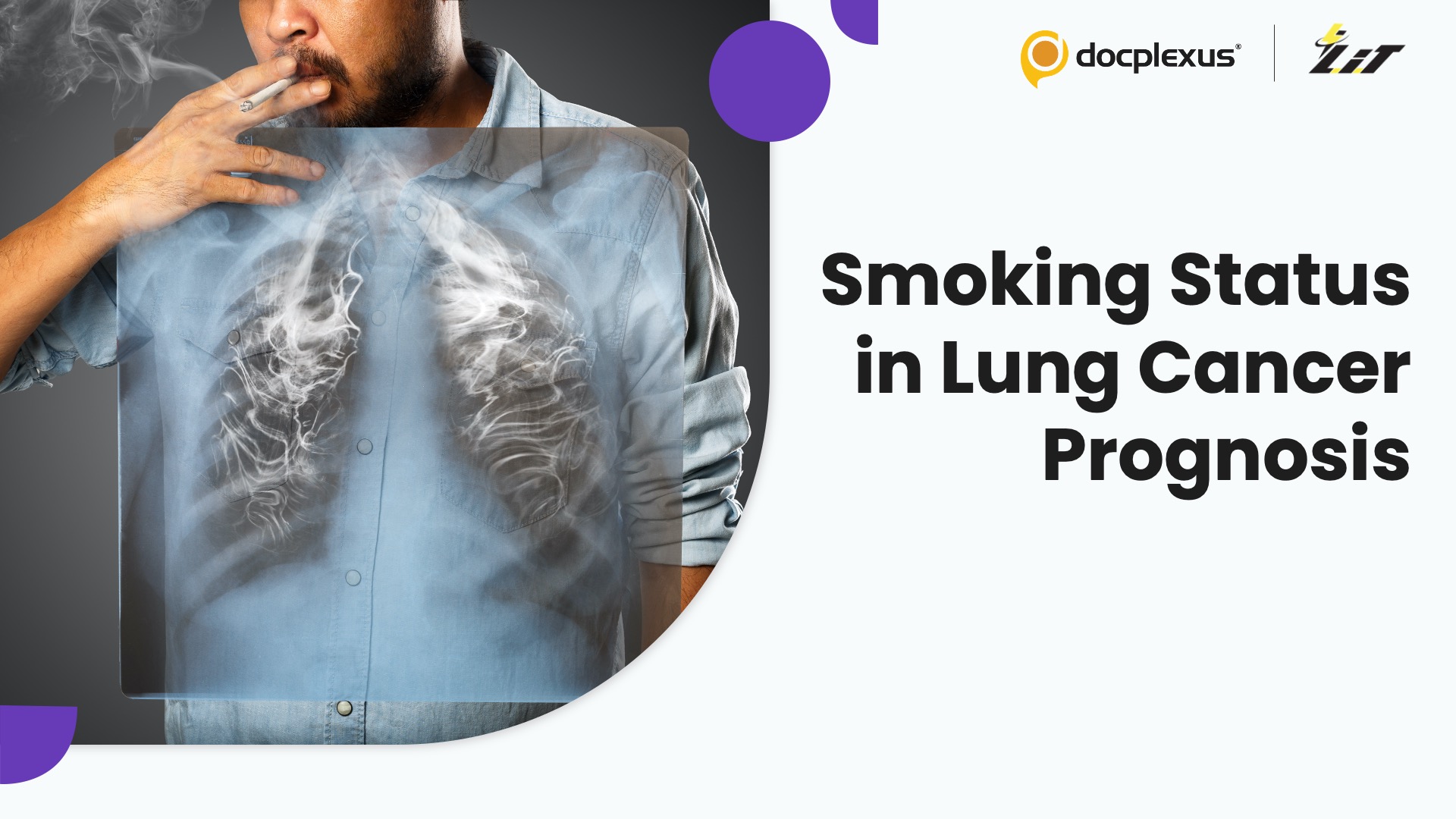 Why Smoking History Should be Part of Lung Cancer Staging