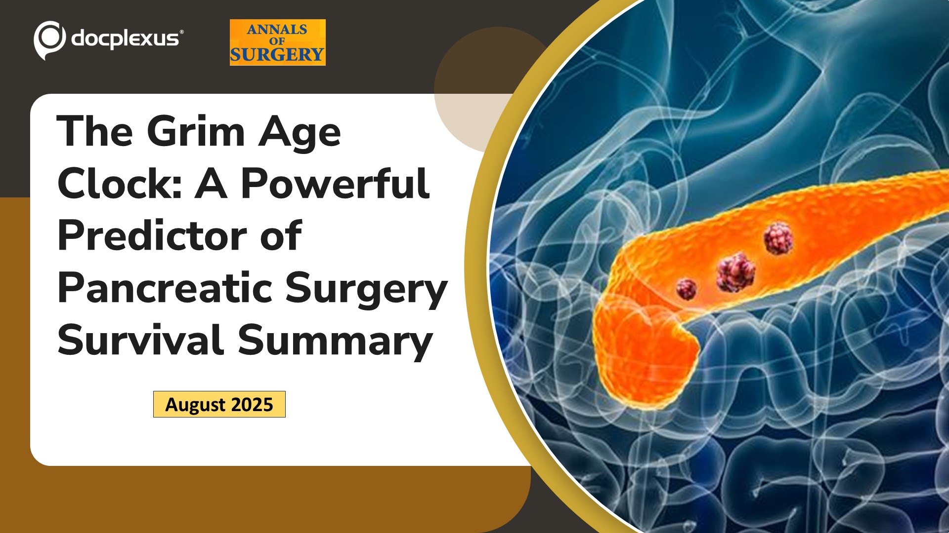 The Grim Age Clock: A Powerful Predictor of Pancreatic Surgery Survival Summary