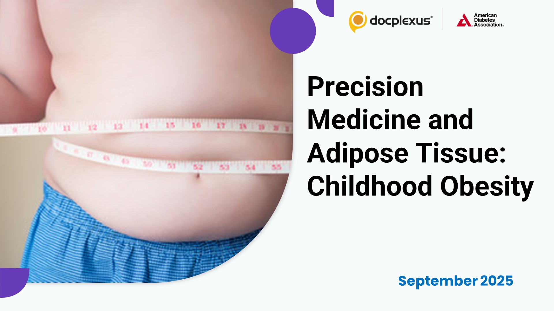 Precision Medicine and Adipose Tissue: Transforming Childhood Obesity Risk Assessment
