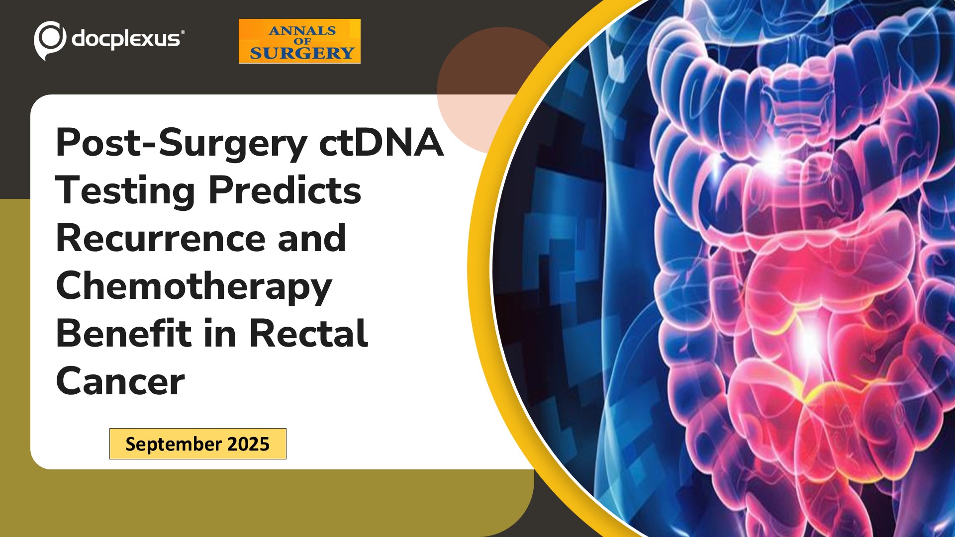 Post-Surgery ctDNA Testing Predicts Recurrence and Chemotherapy Benefit in Rectal Cancer