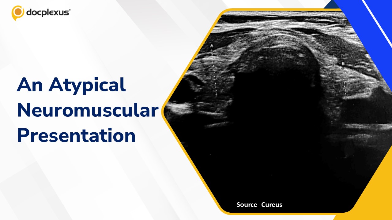 An Unusual Presentation with Neuromuscular Features