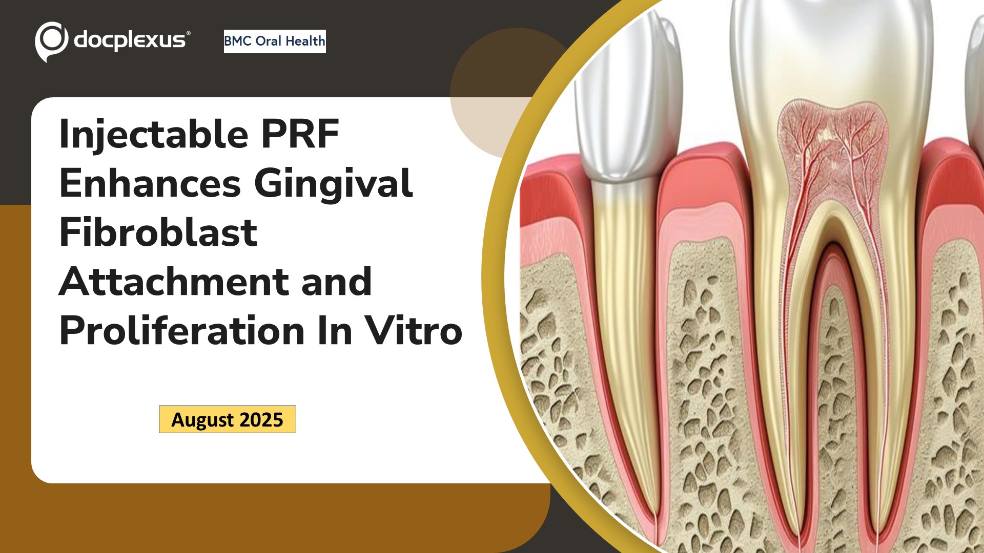 Injectable PRF Enhances Gingival Fibroblast Attachment and Proliferation In Vitro