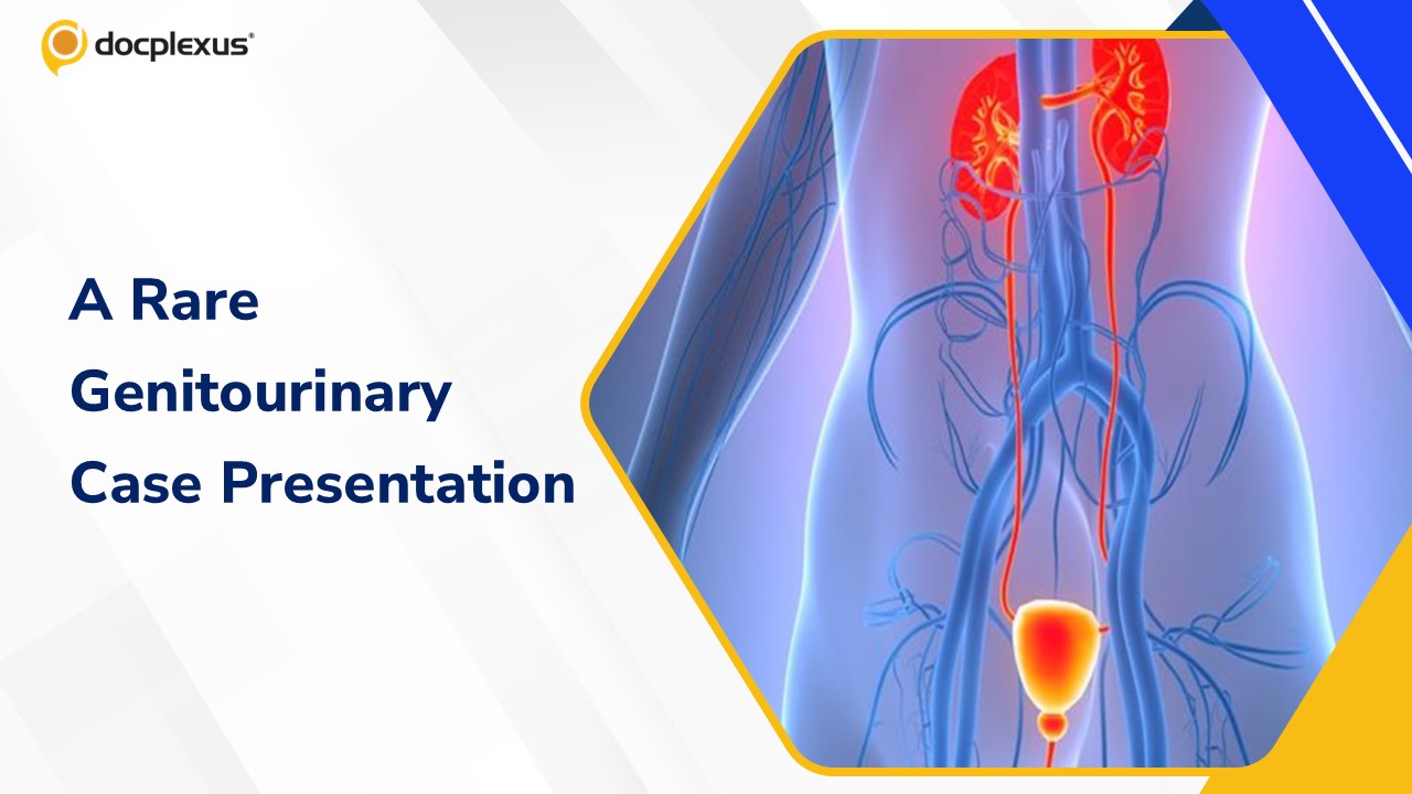 An Uncommon Presentation of a Genitourinary Disorder