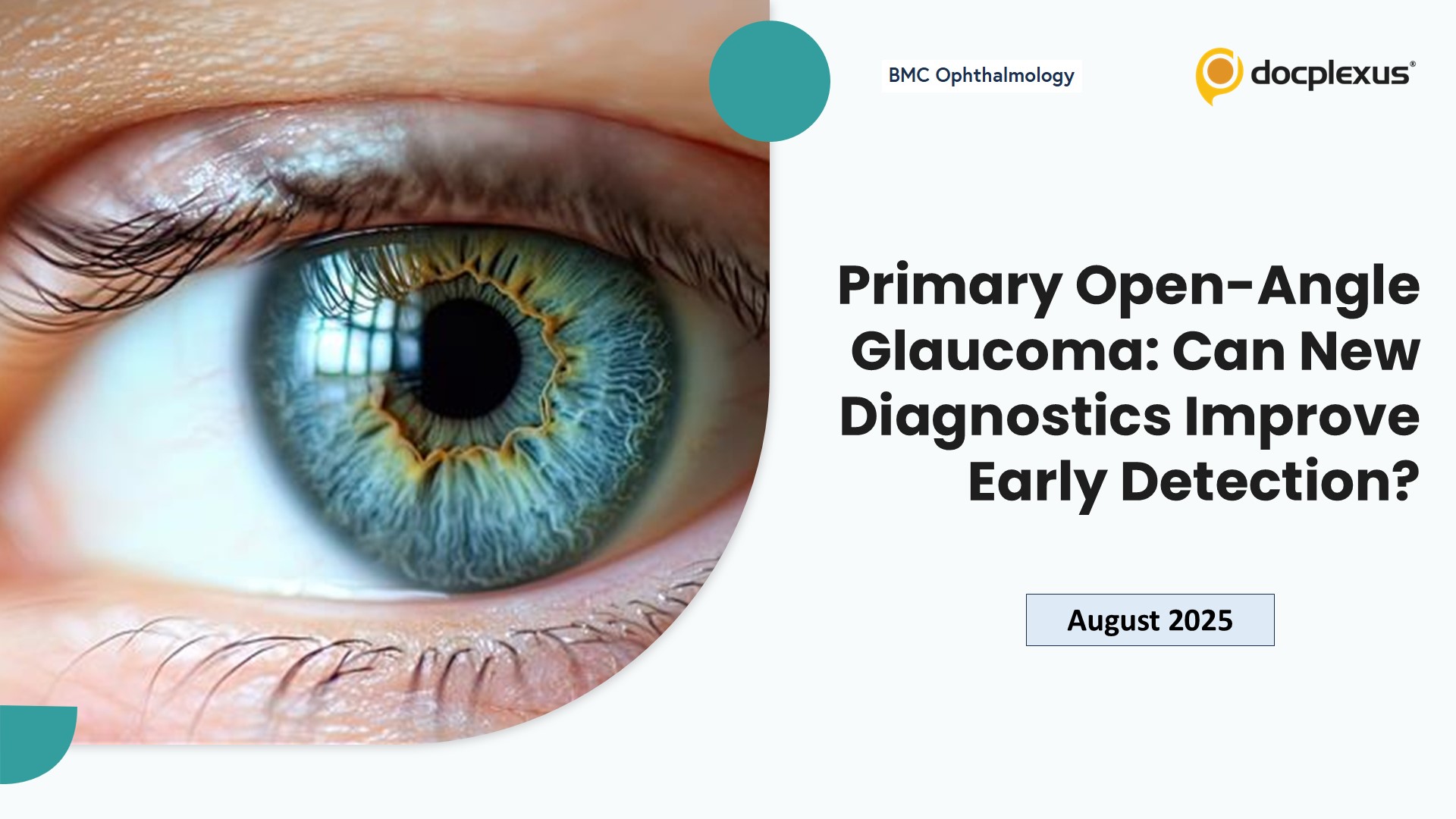 Primary Open-Angle Glaucoma: Can New Diagnostics Improve Early Detection?