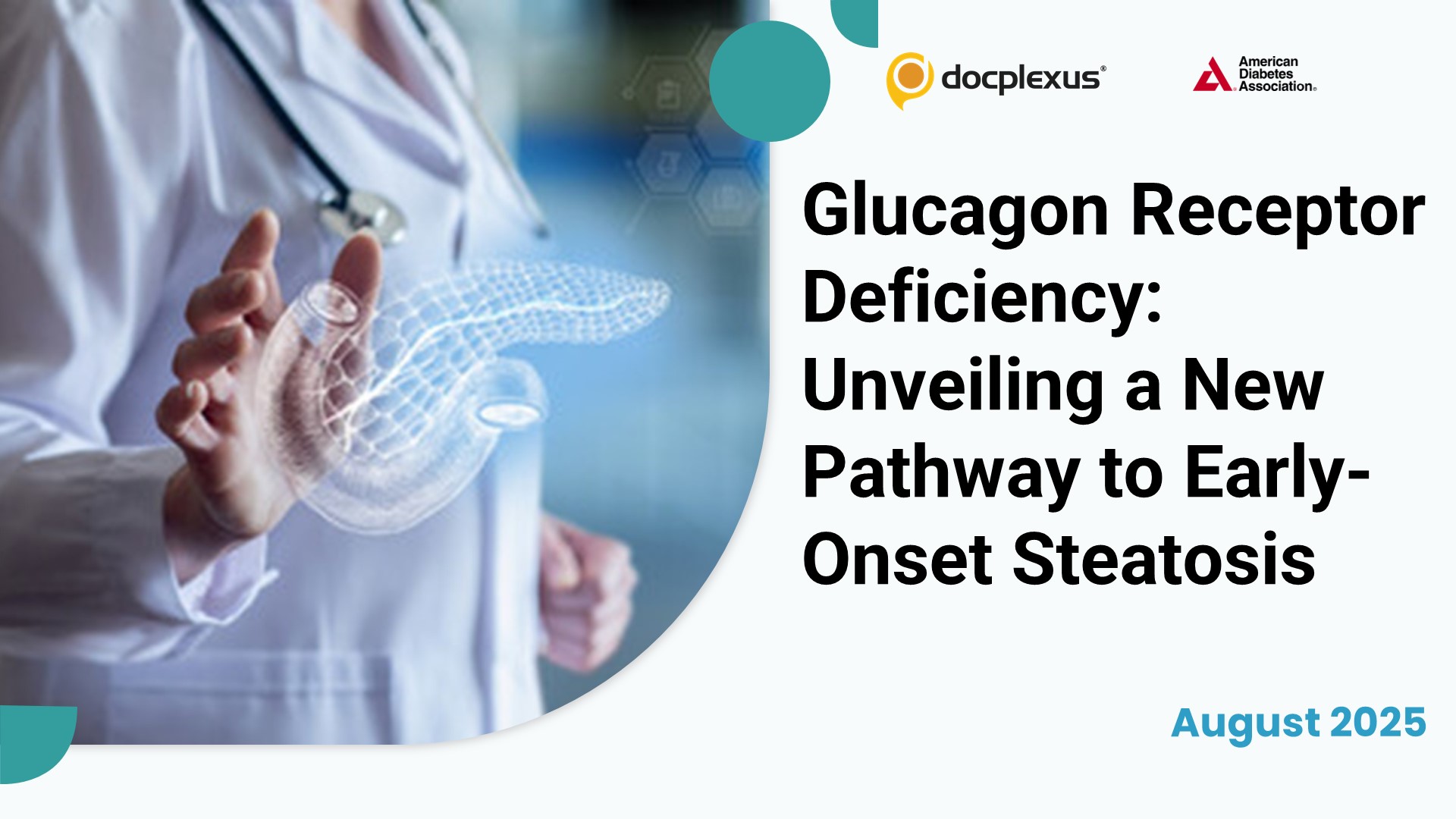 Glucagon Receptor Deficiency: Unveiling a New Pathway to Early-Onset Steatosis