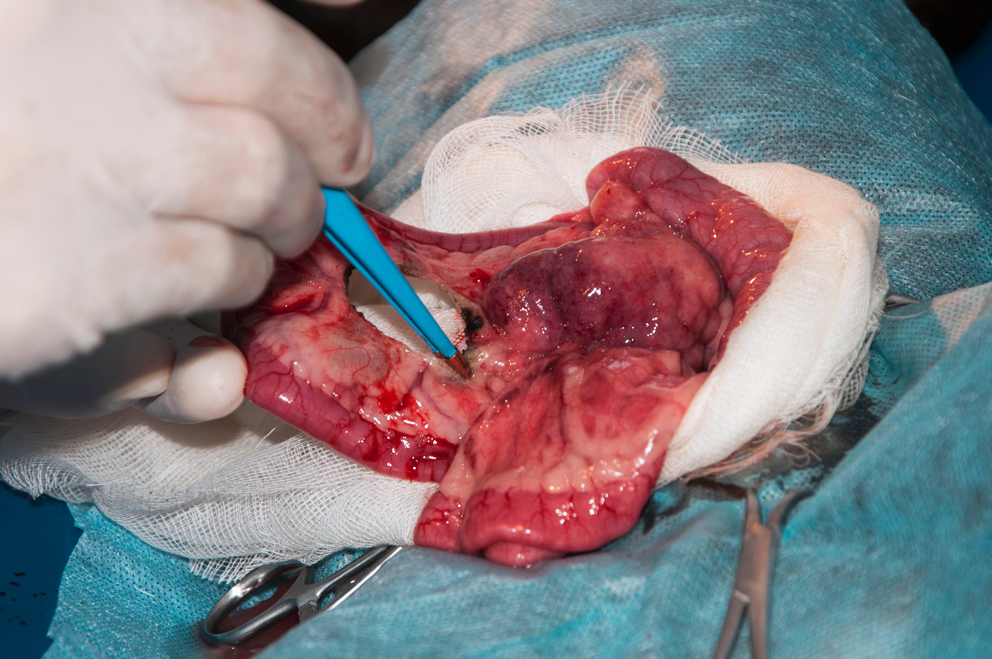 Mesenteric Thrombosis: The Silent Killer