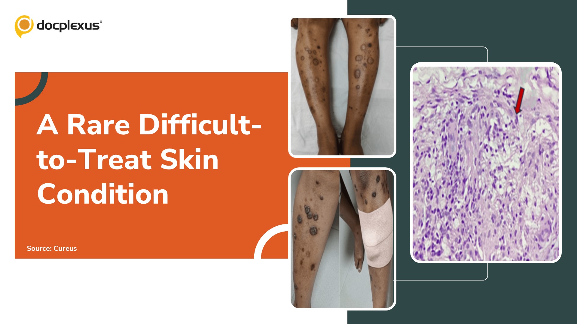 Diagnosis this Rare and Challenging Dermatological Condition