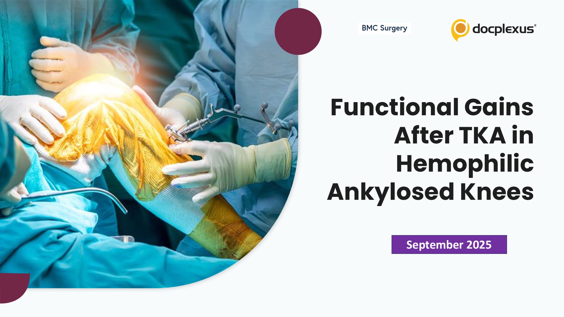 Functional Gains After TKA in Hemophilic Ankylosed Knees