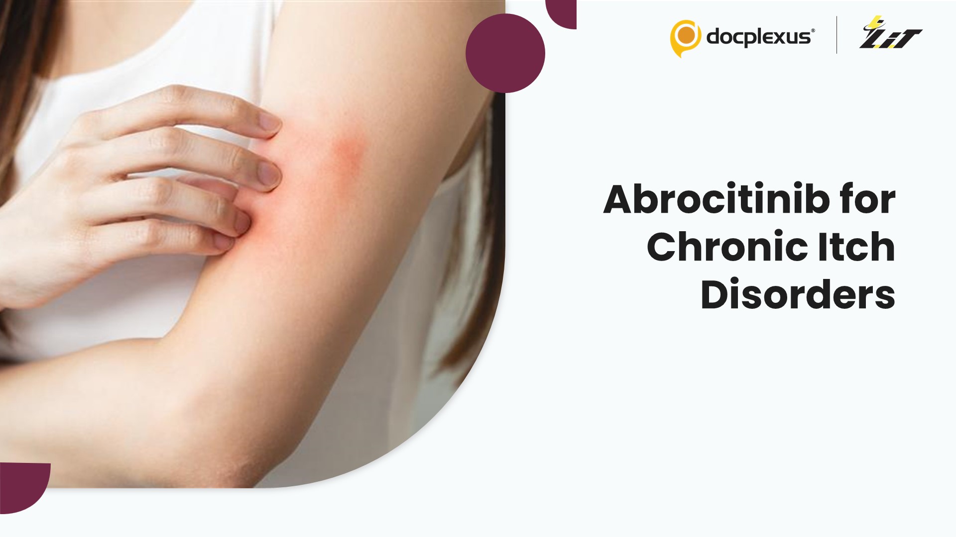 Taming Chronic Itch: Abrocitinib as a Promising Therapy
