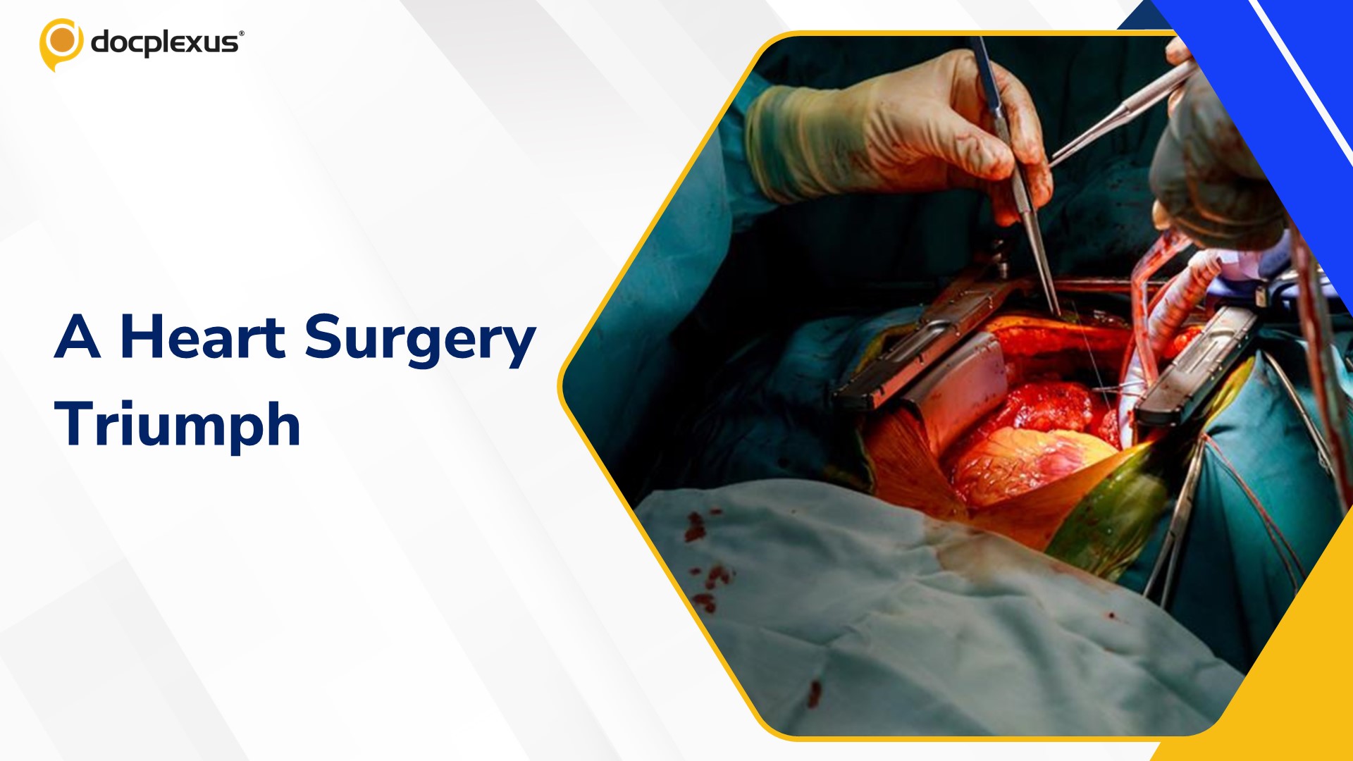 Life-Saving Fourth Heart Surgery: A Rare Cardiac Success in Faridabad