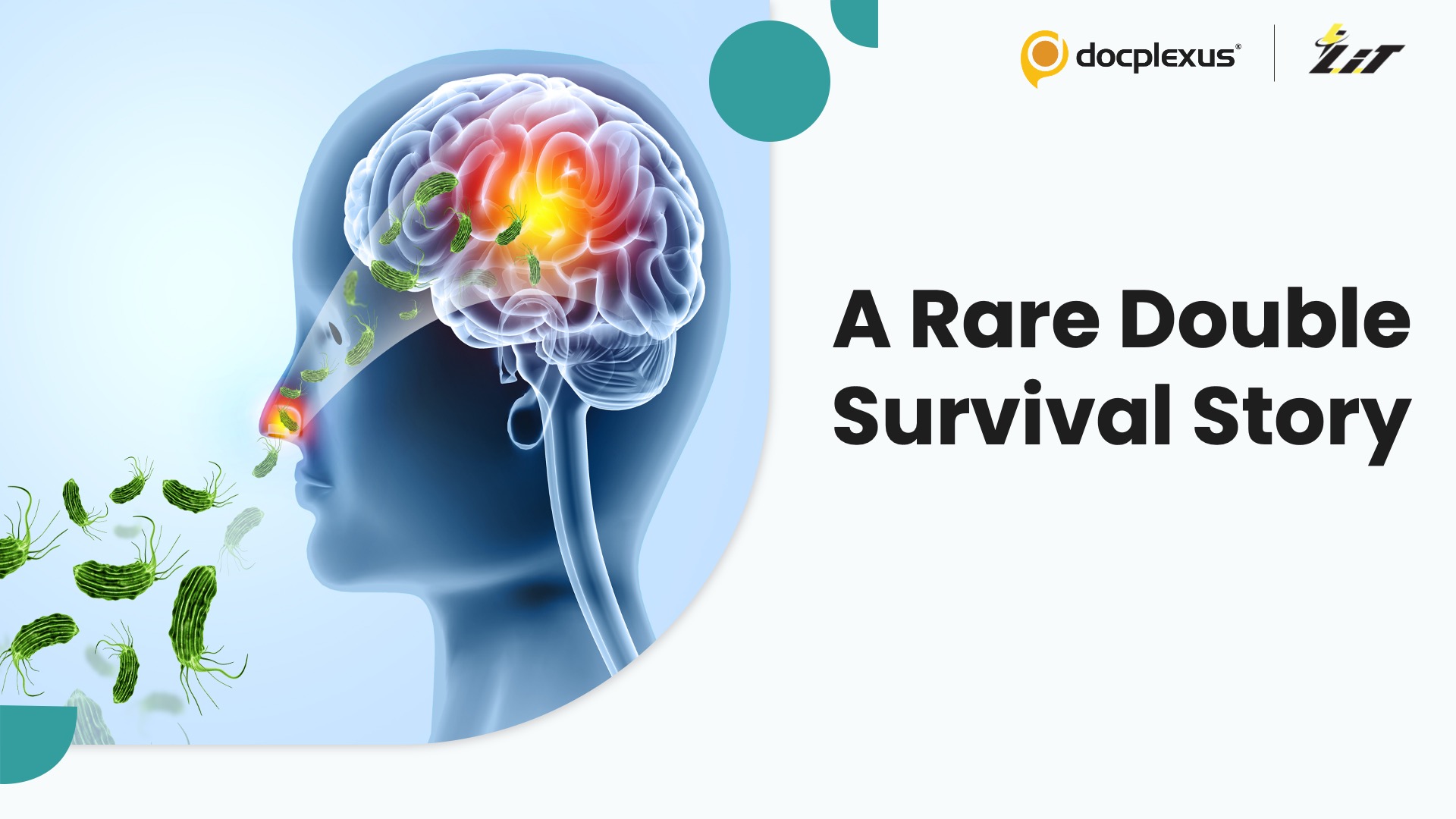 Kerala Doctors Beat Dual Brain Infections in World-First Success