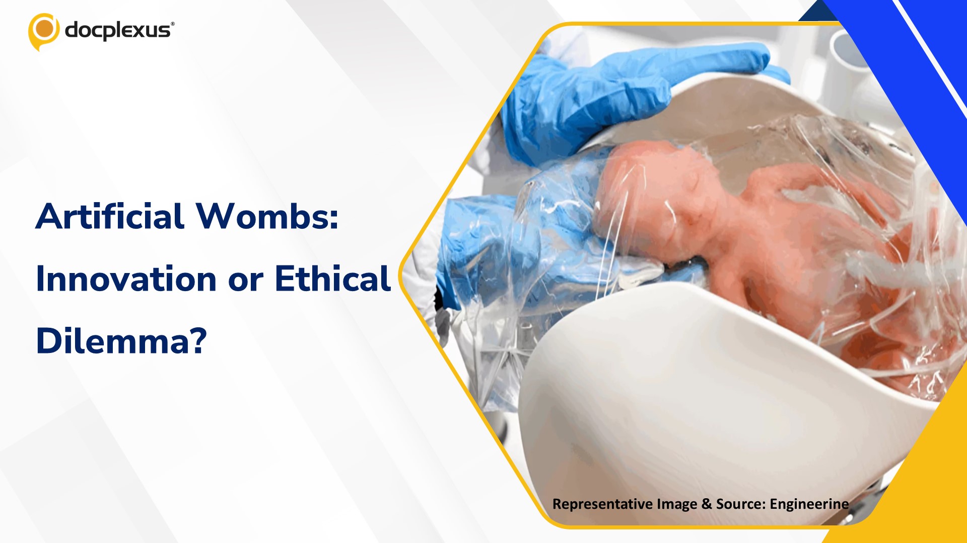 Artificial Womb Technology: Breakthrough in Neonatal Care or Ethical Red Line?