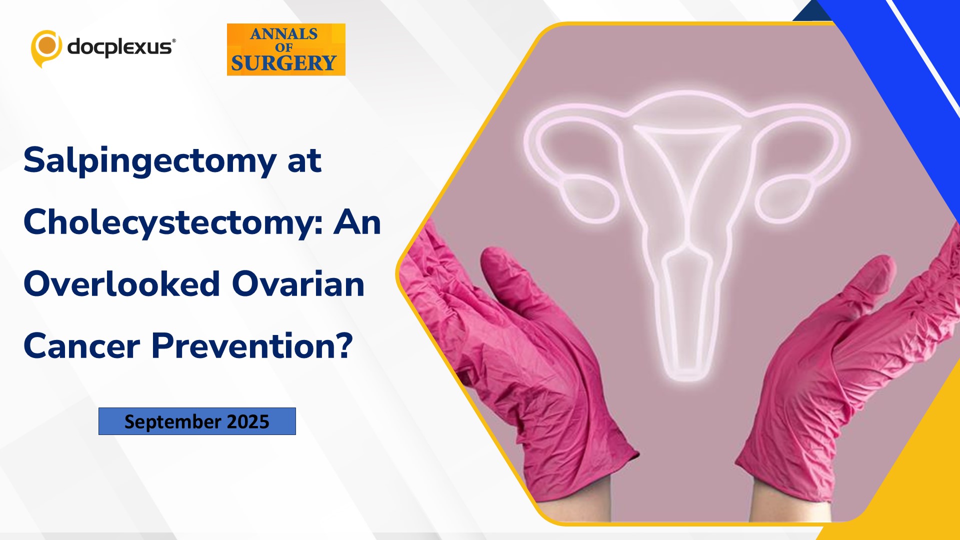 Salpingectomy at Cholecystectomy: An Overlooked Ovarian Cancer Prevention?