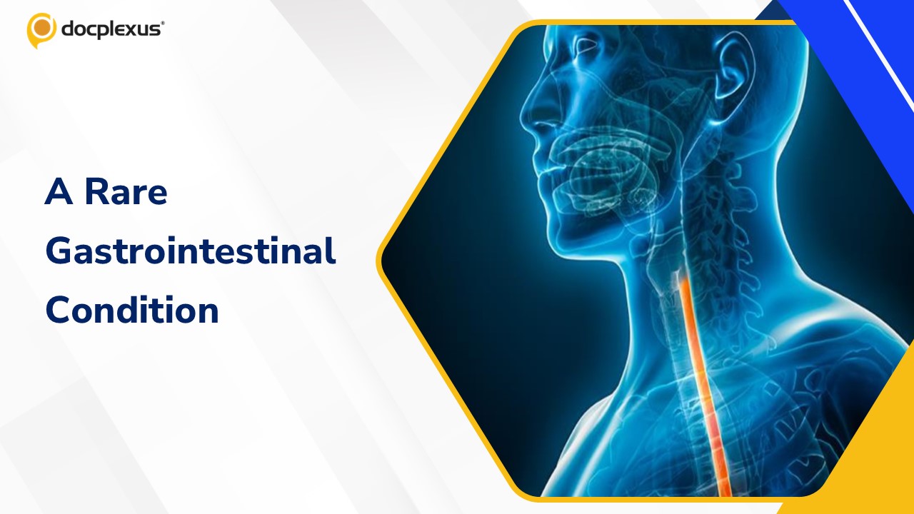 Diagnosis This Rare Gastrointestinal Condition